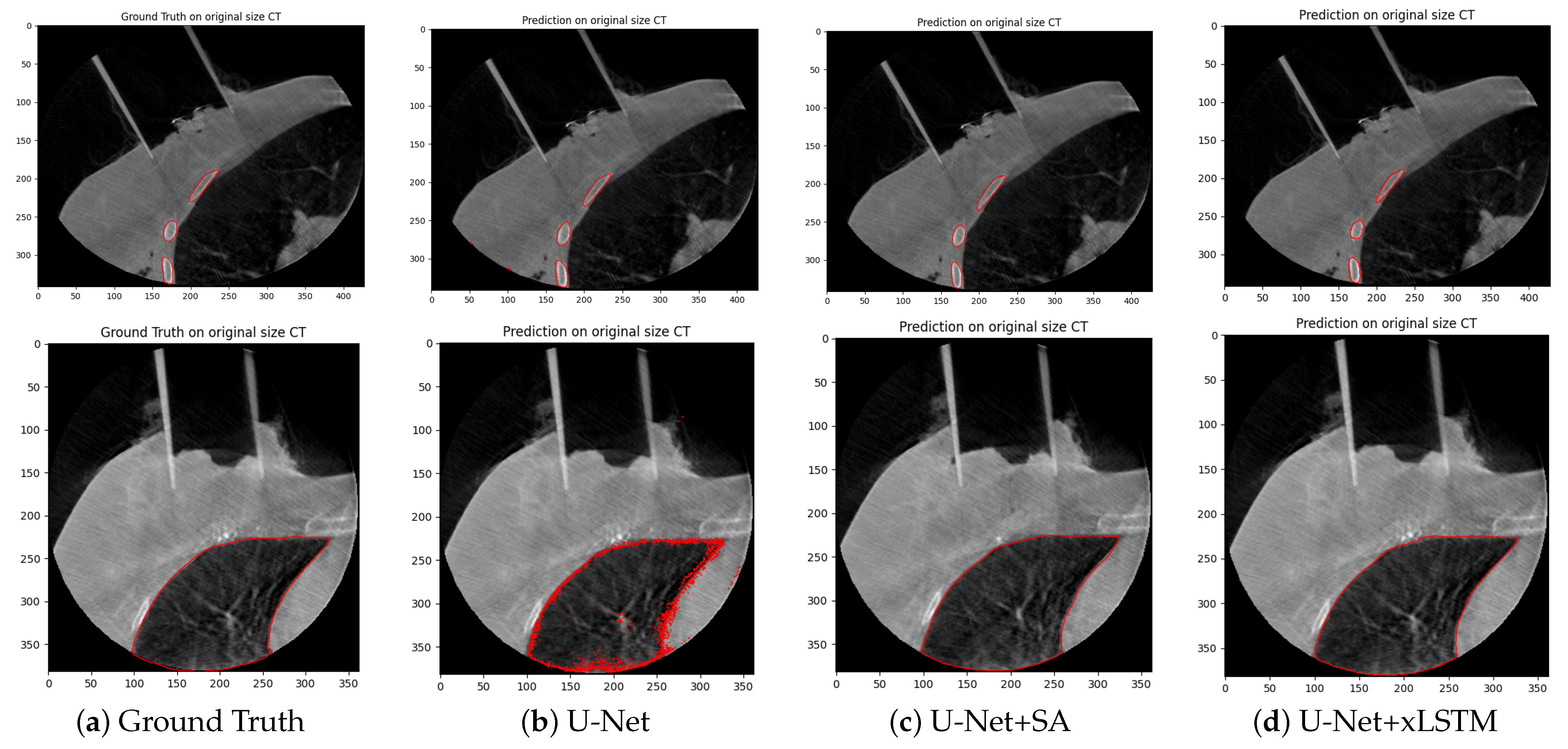Cancers 17 00485 g003