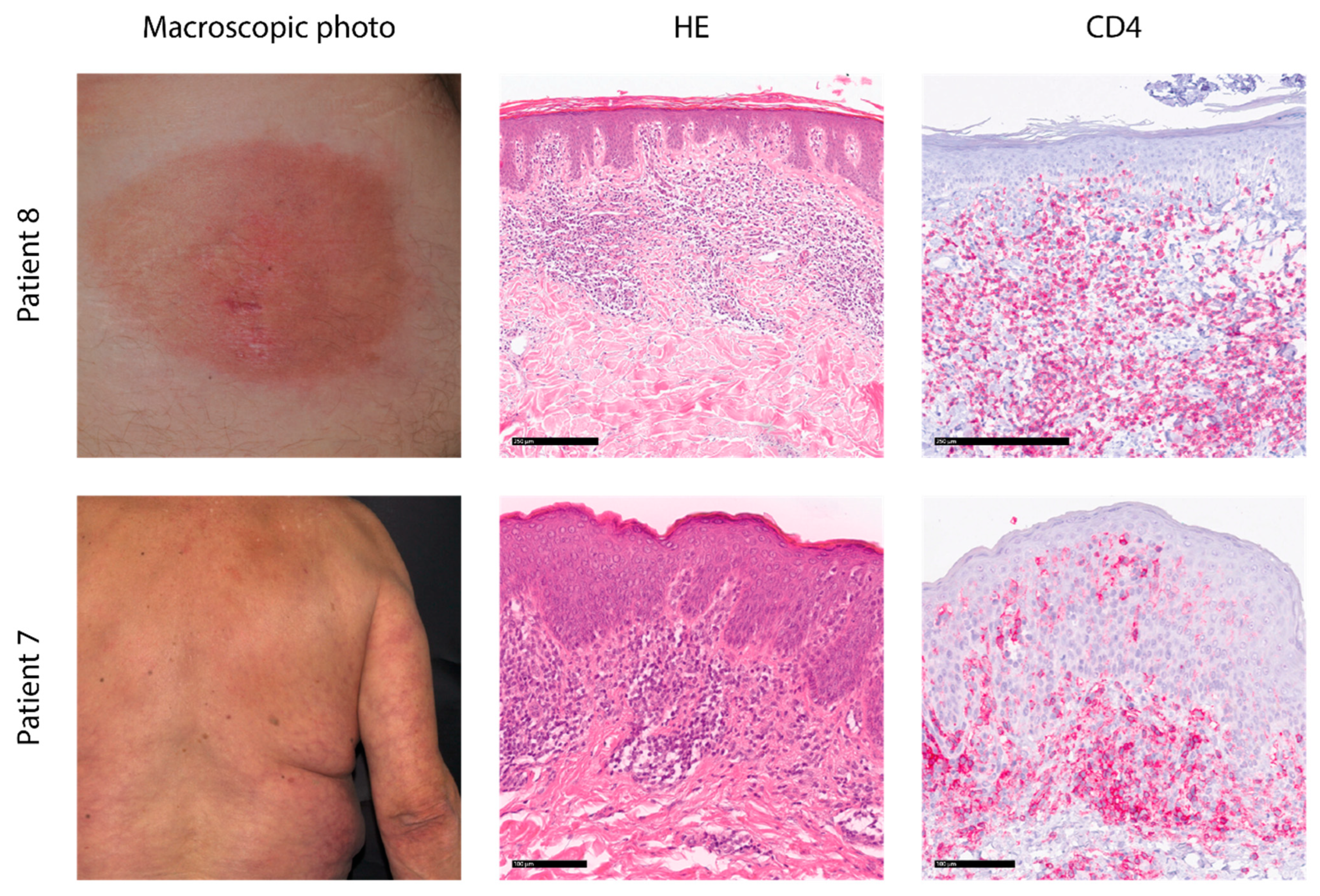 Cancers 17 00556 g001