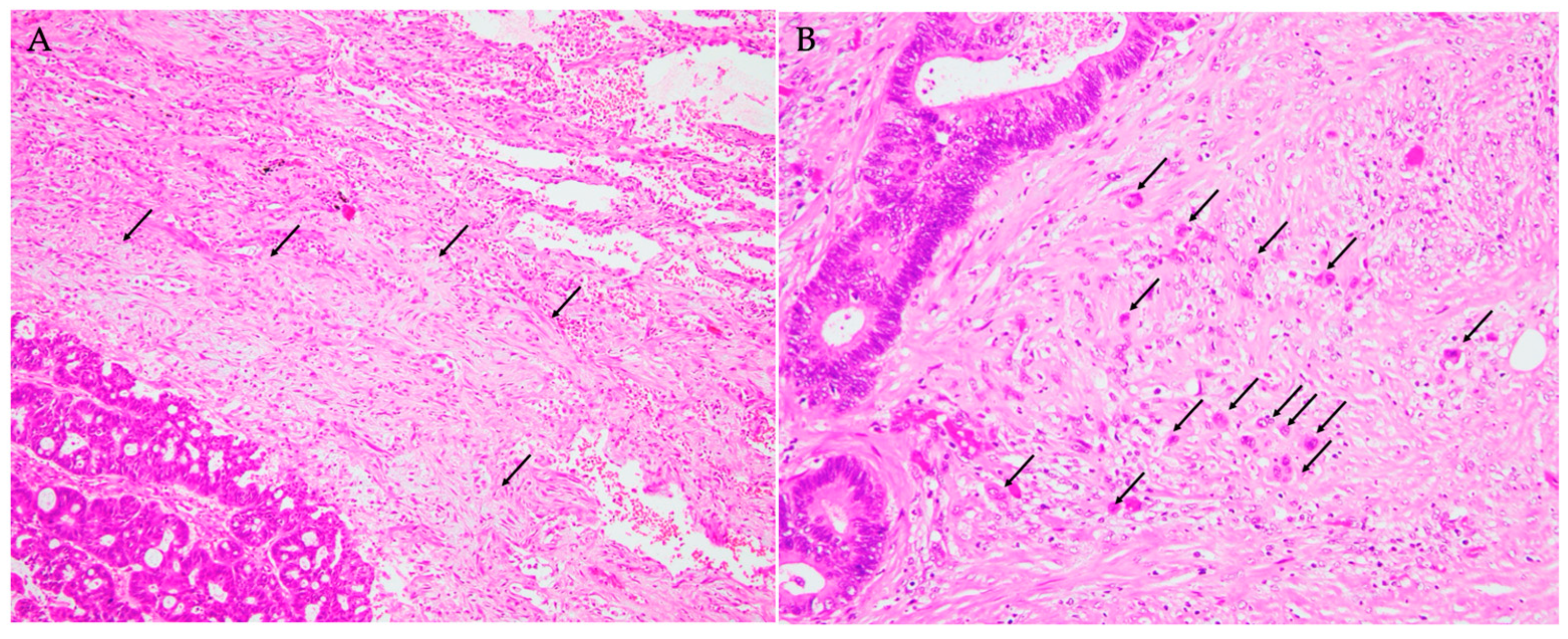 Cancers 17 00583 g001