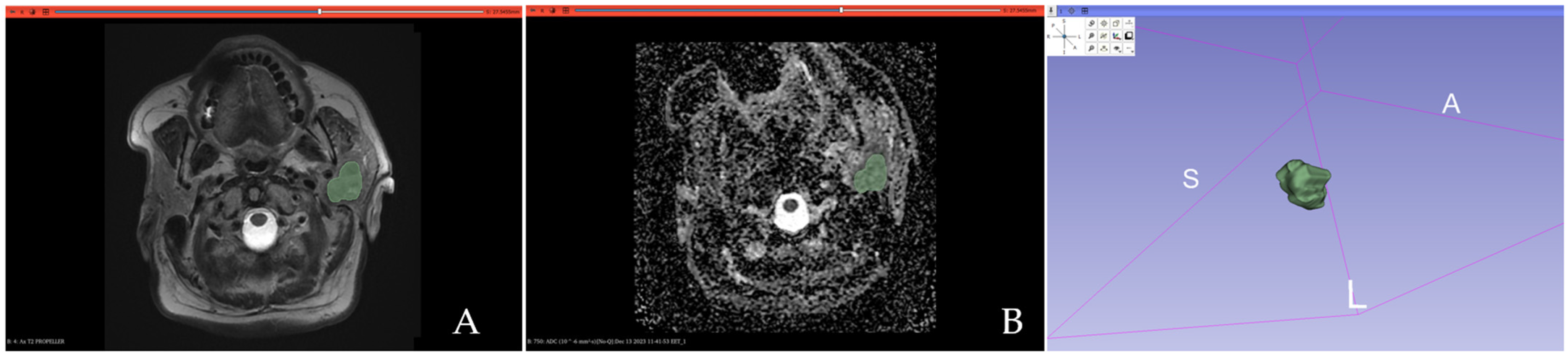 Cancers 17 00620 g001