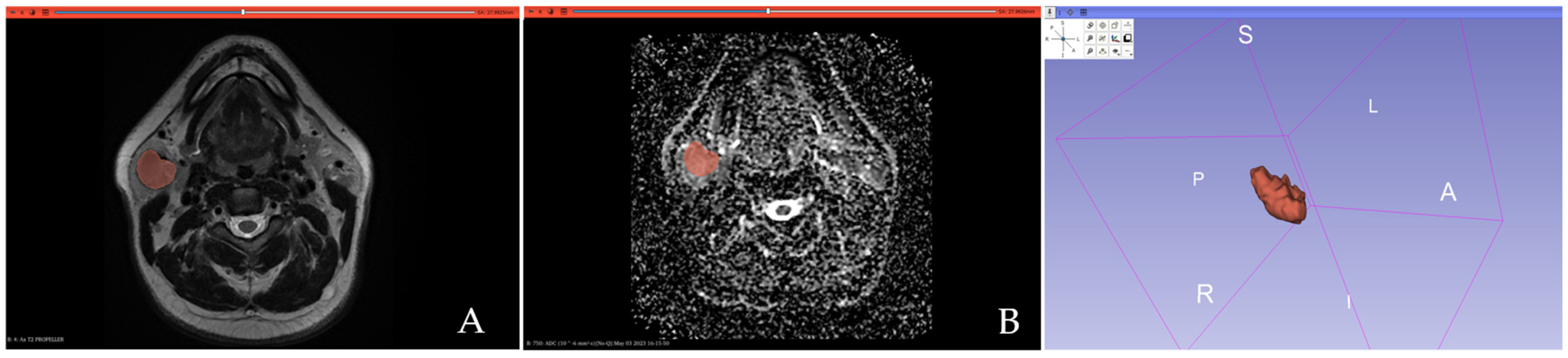 Cancers 17 00620 g002