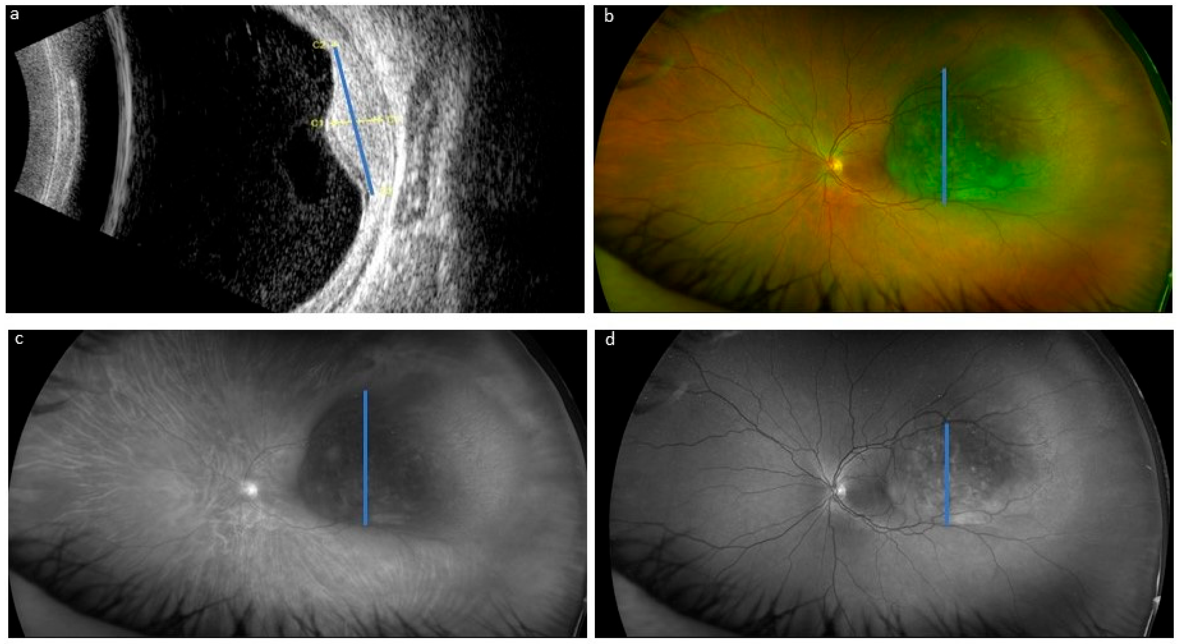 Cancers 17 00642 g001