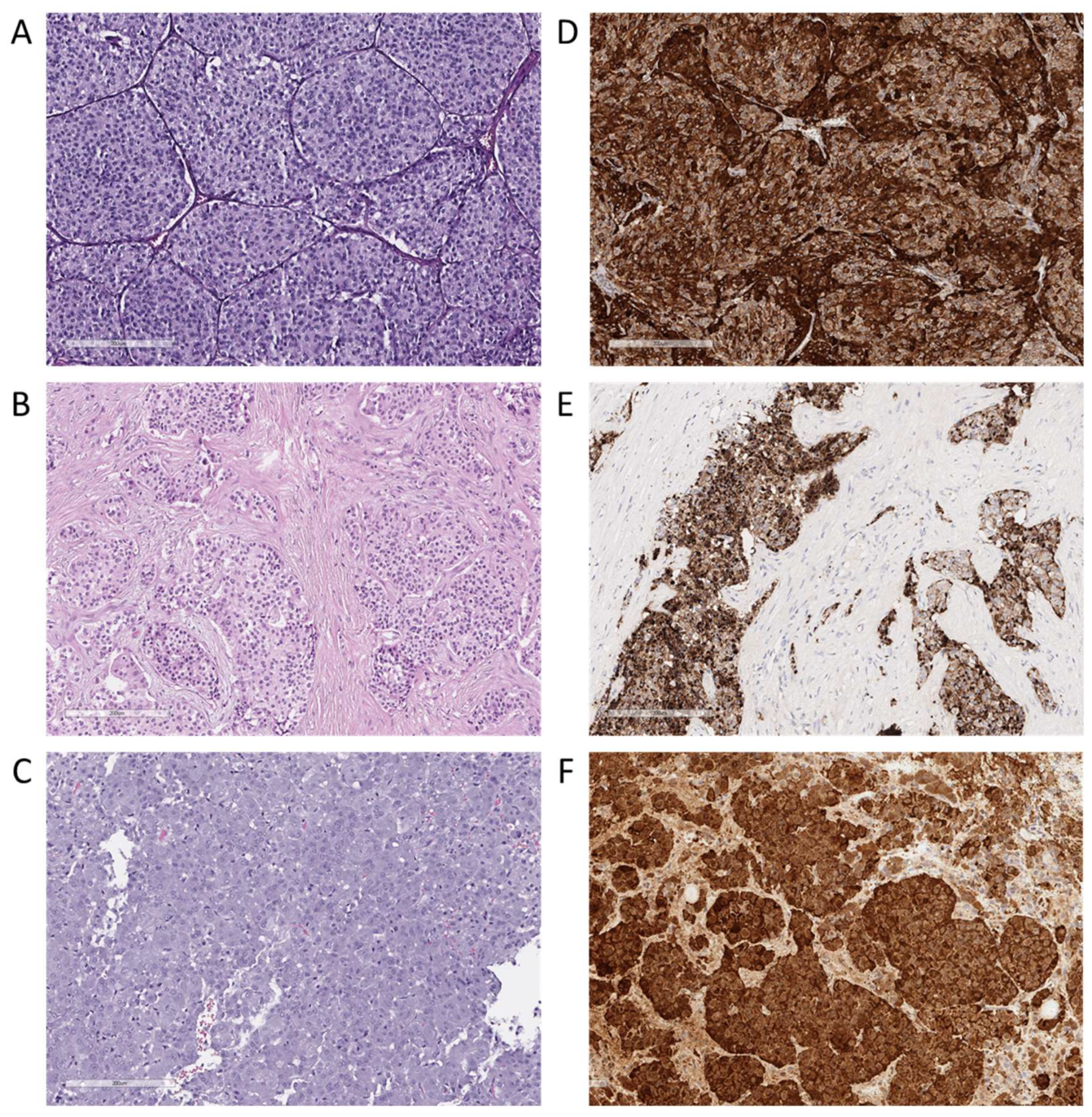 Cancers 17 00658 g001