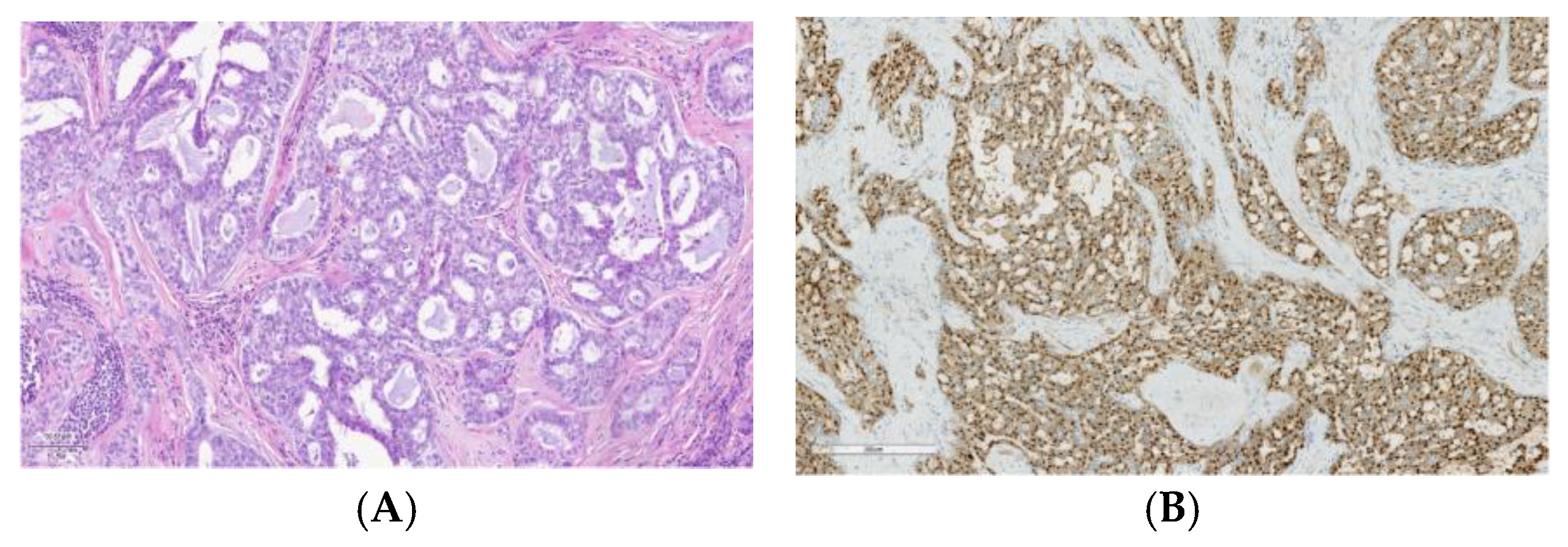 Cancers 17 00660 g002