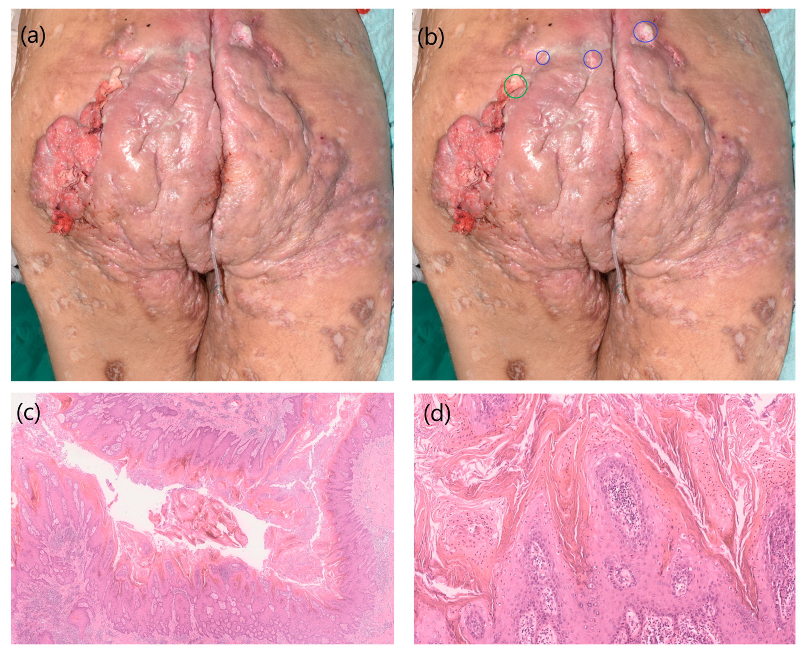 Cancers 17 00702 g001a