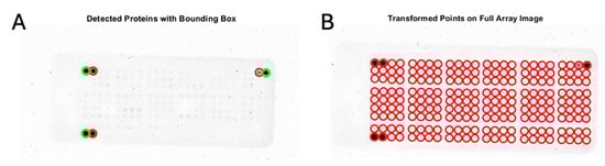 Cancers 17 00721 g0a4