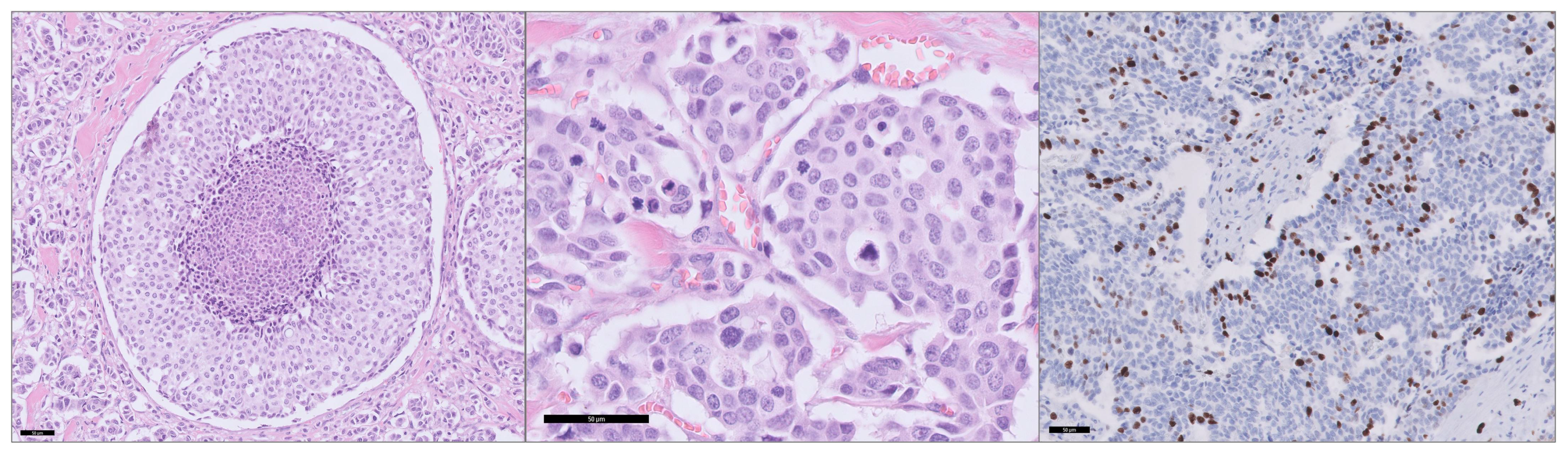 Cancers 17 00737 g001