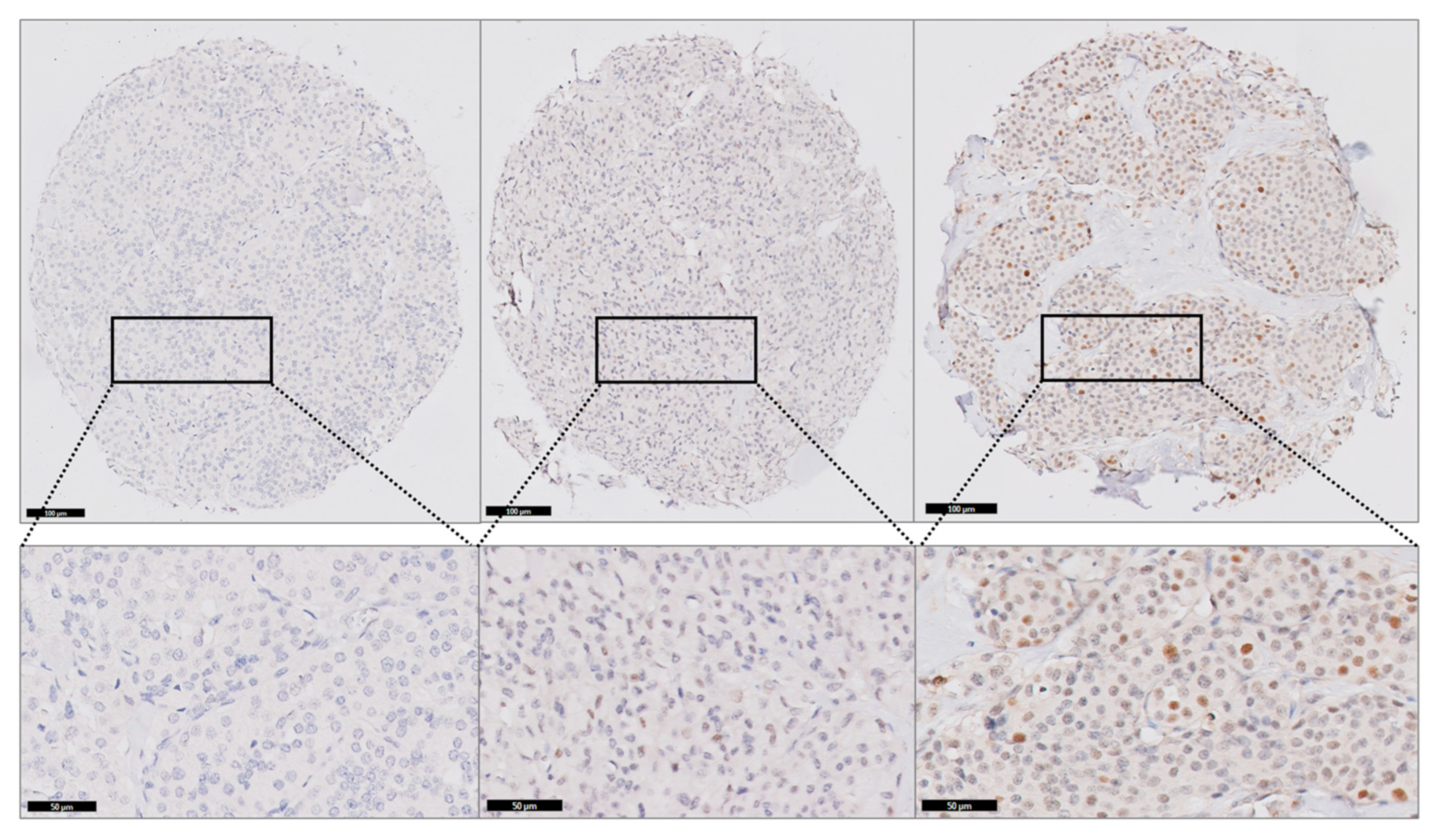 Cancers 17 00737 g002