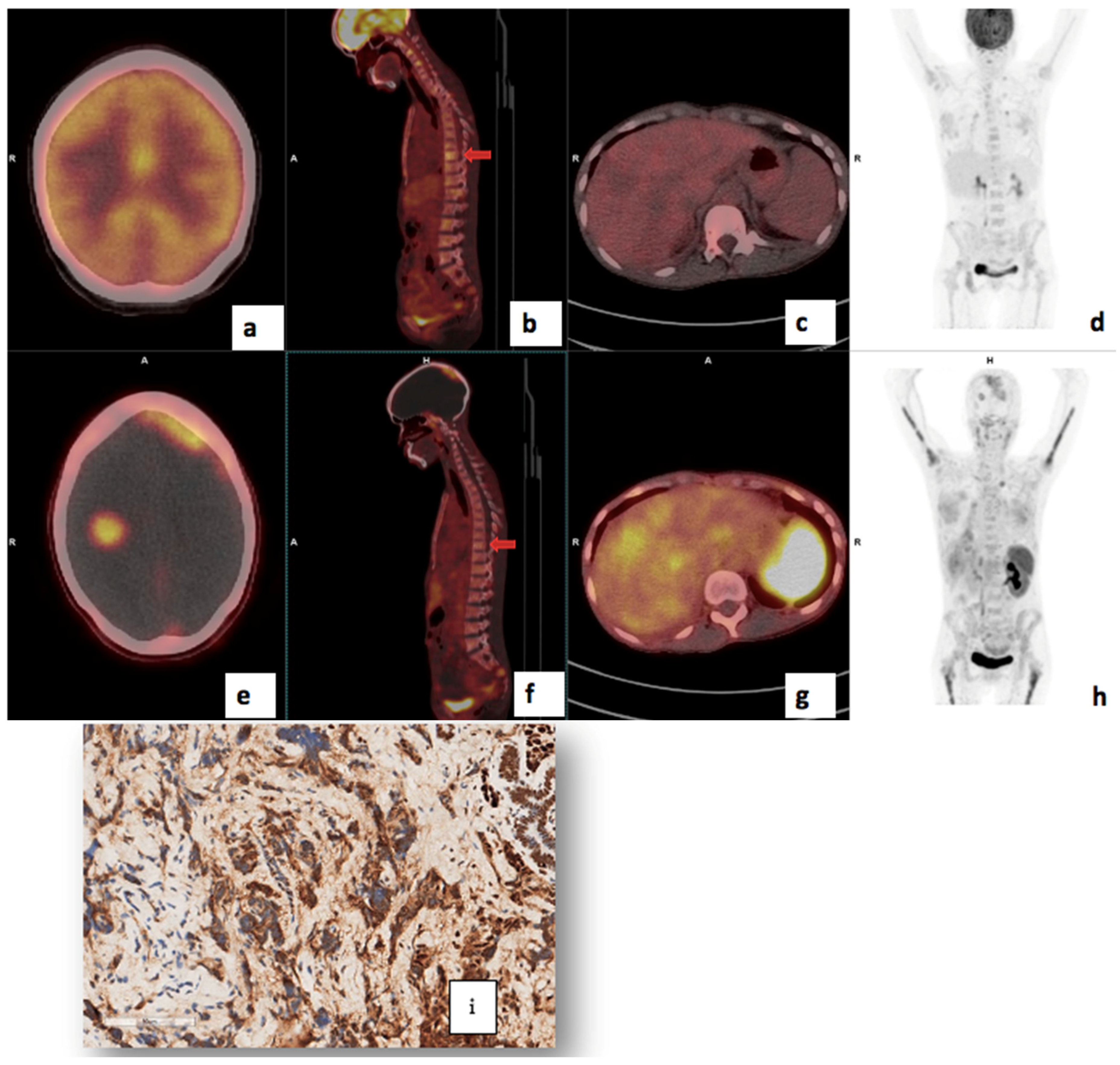 Cancers 17 00763 g005 Cancers 17 00763 g005