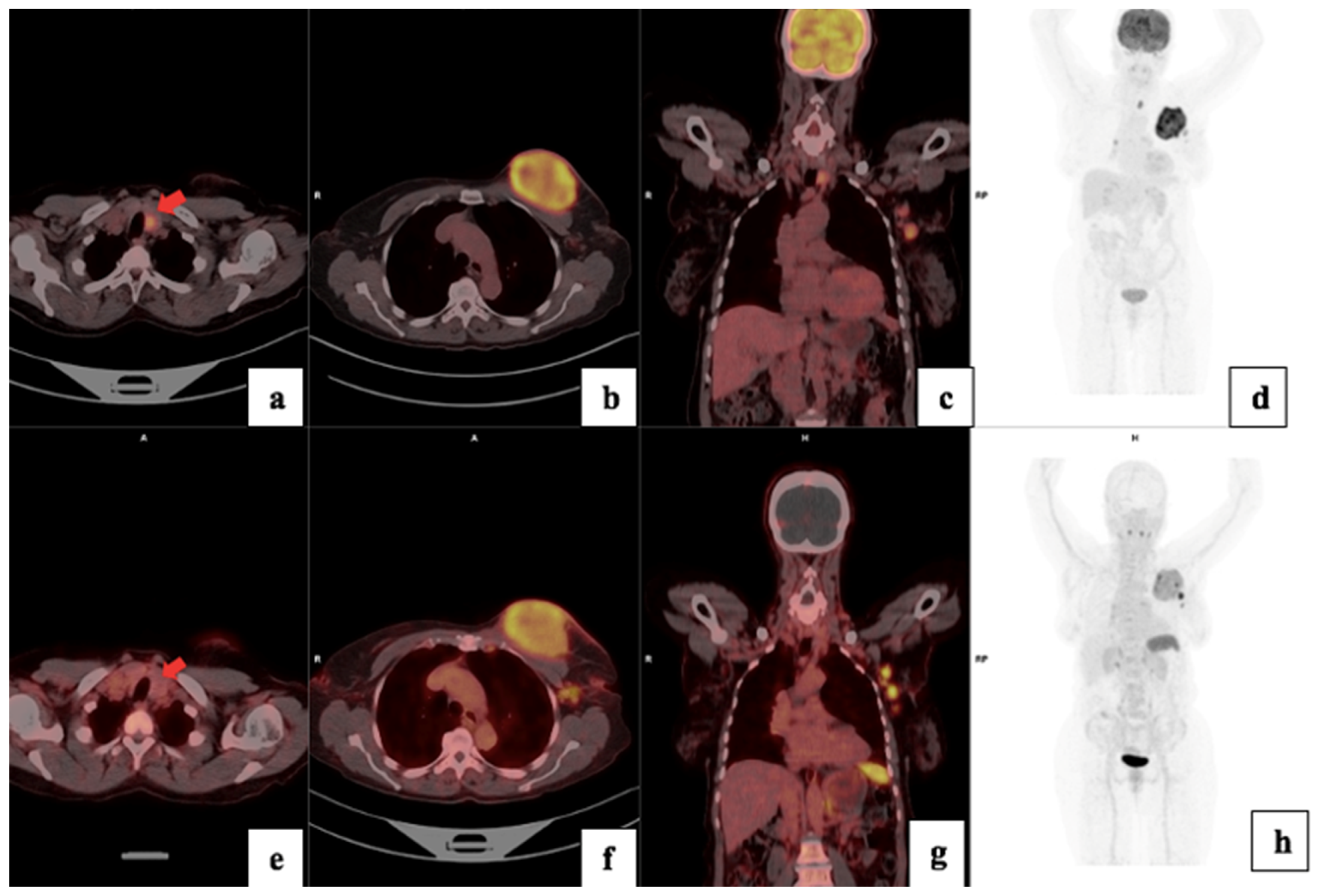 Cancers 17 00763 g006 Cancers 17 00763 g006
