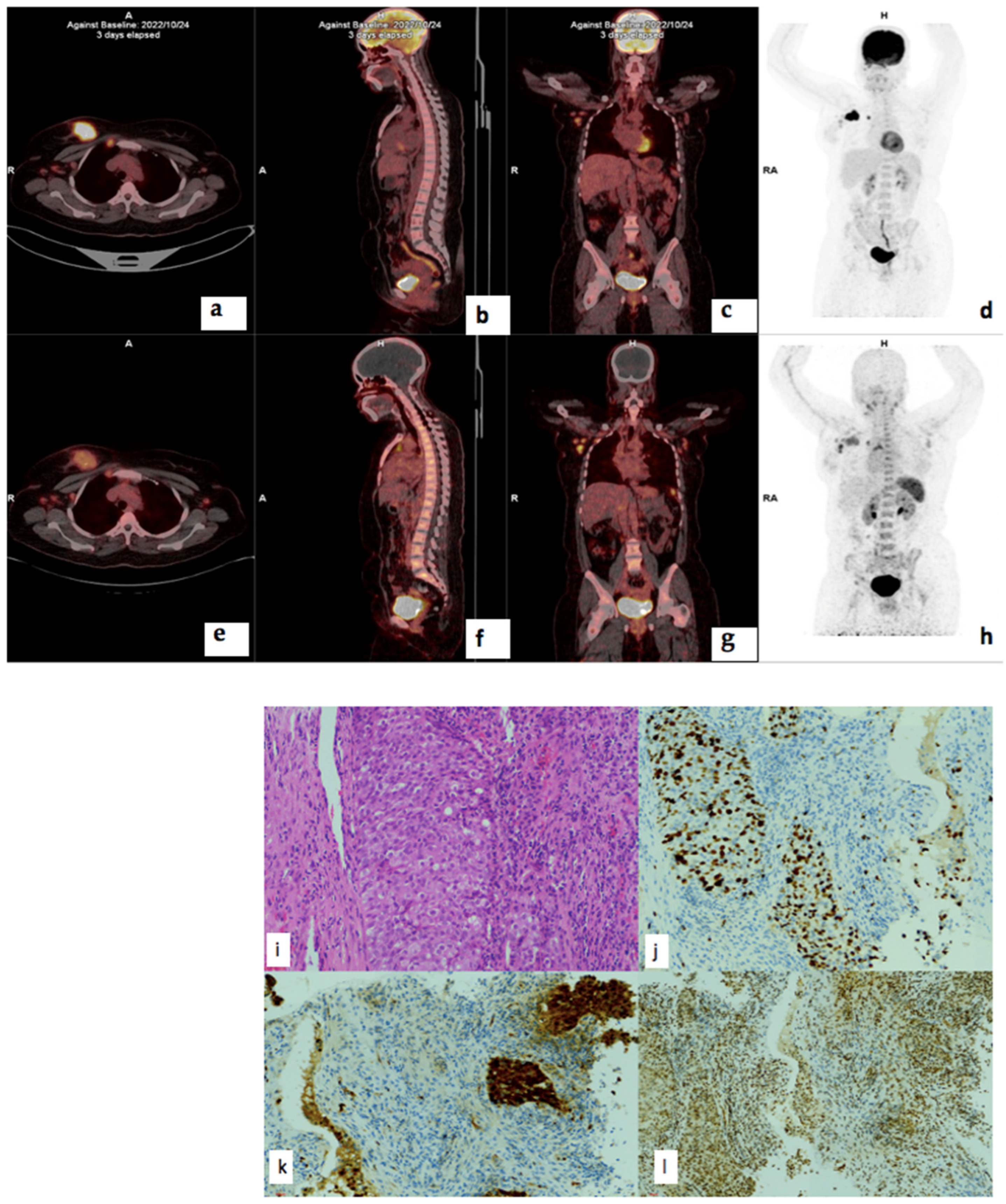 Cancers 17 00763 g008 Cancers 17 00763 g008