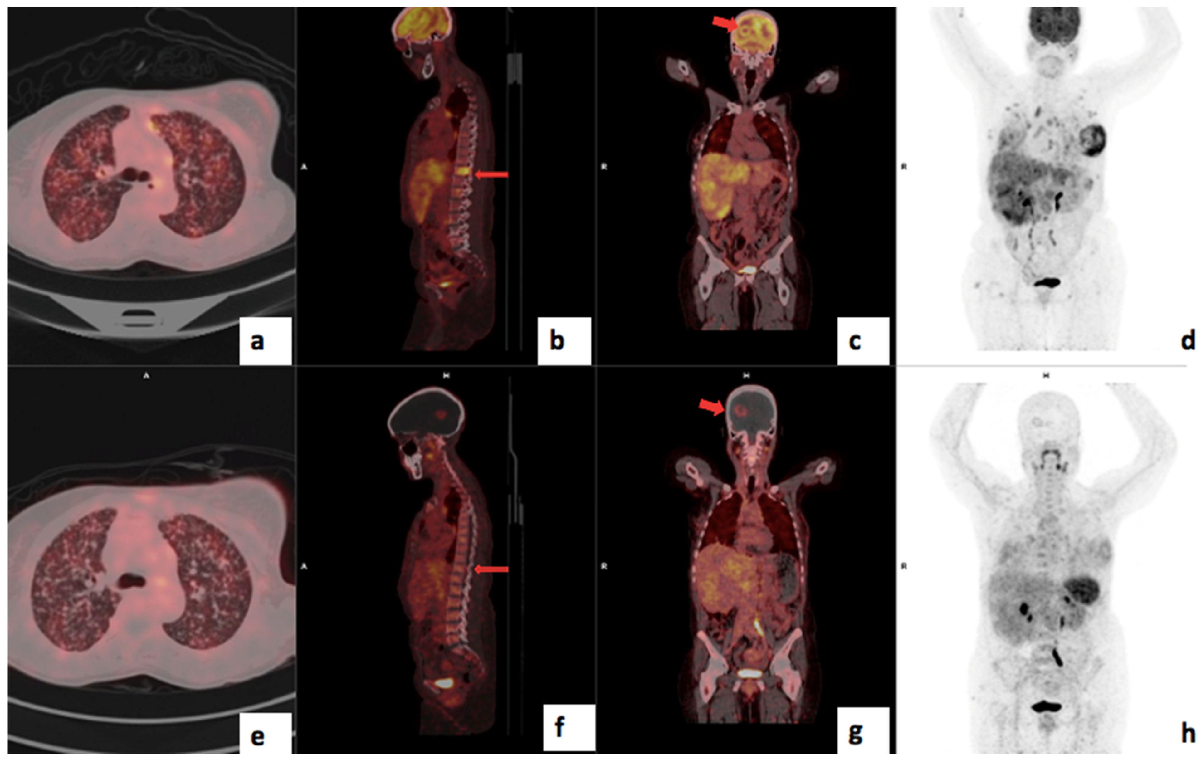 Cancers 17 00763 g009 Cancers 17 00763 g009