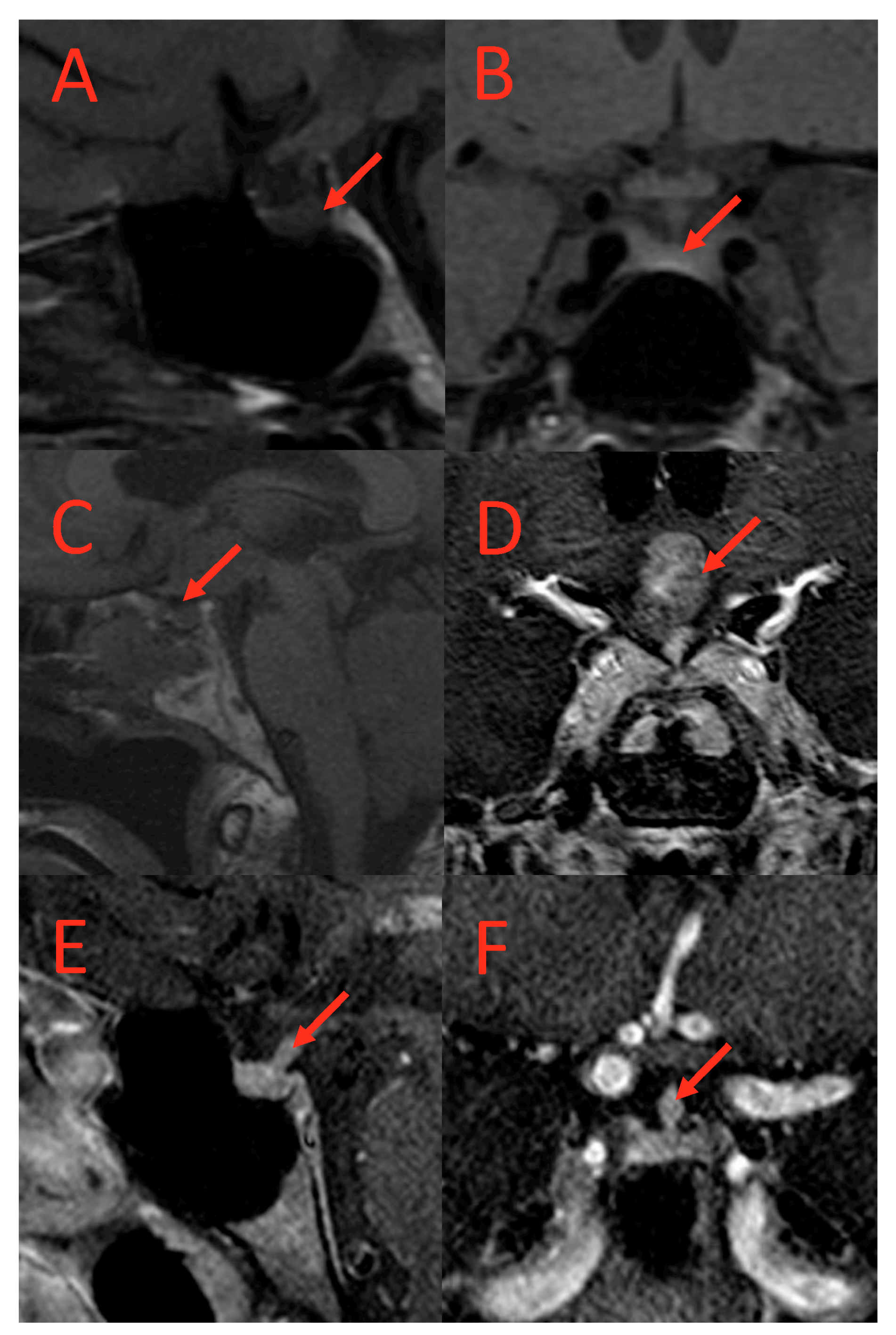 Cancers 17 00824 g002