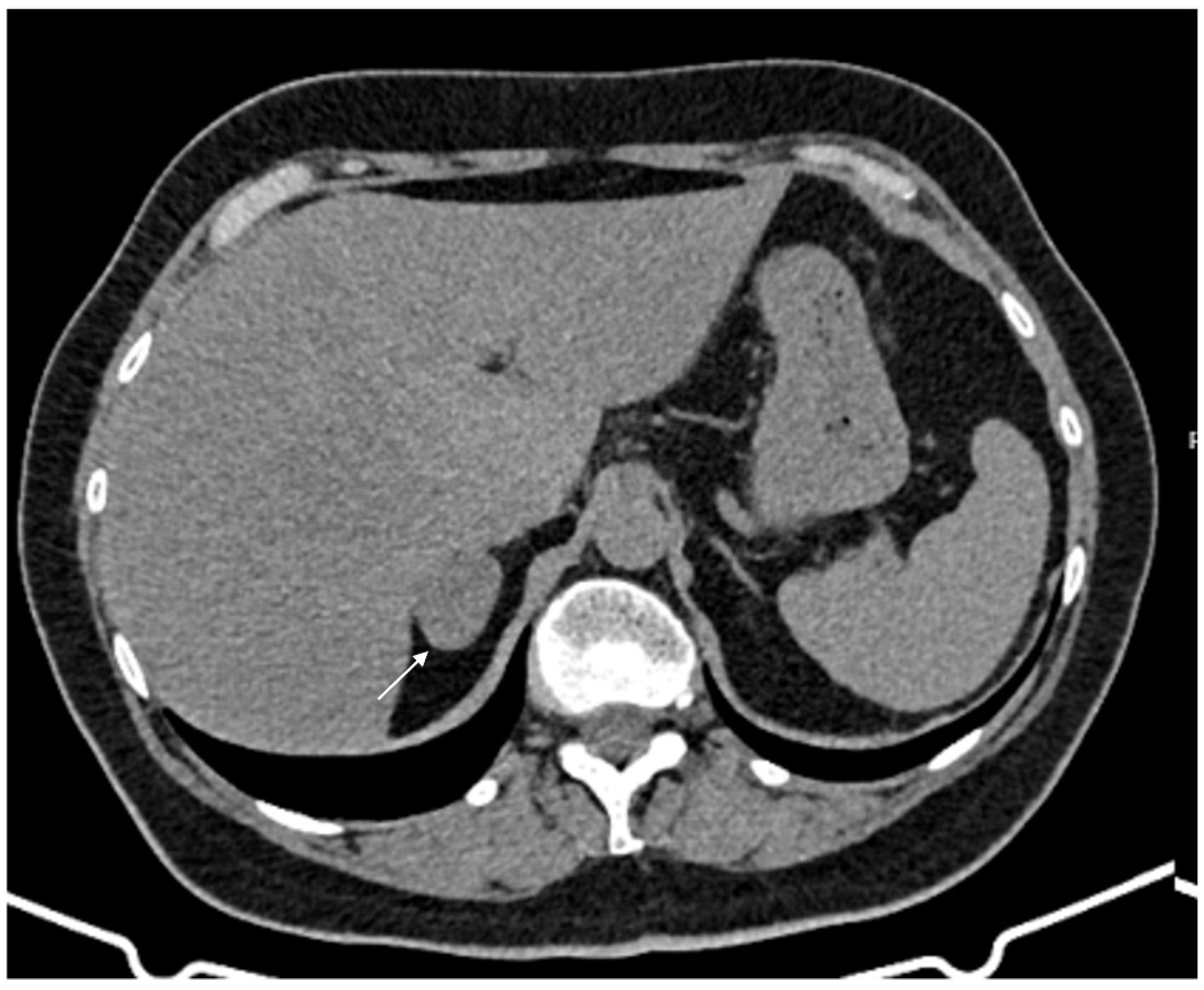 Cancers 17 00849 g001 Cancers 17 00849 g001