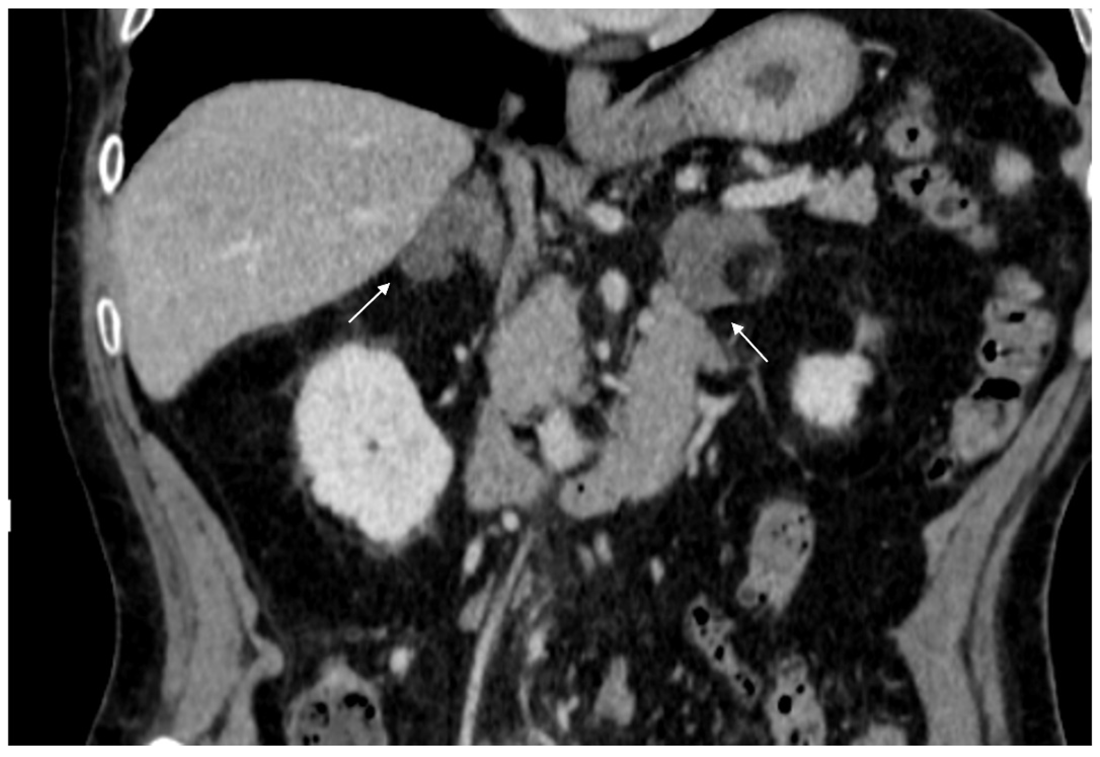 Cancers 17 00849 g002 Cancers 17 00849 g002