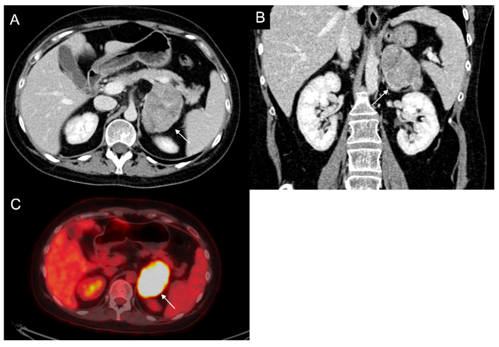 Cancers 17 00849 g003 Cancers 17 00849 g003