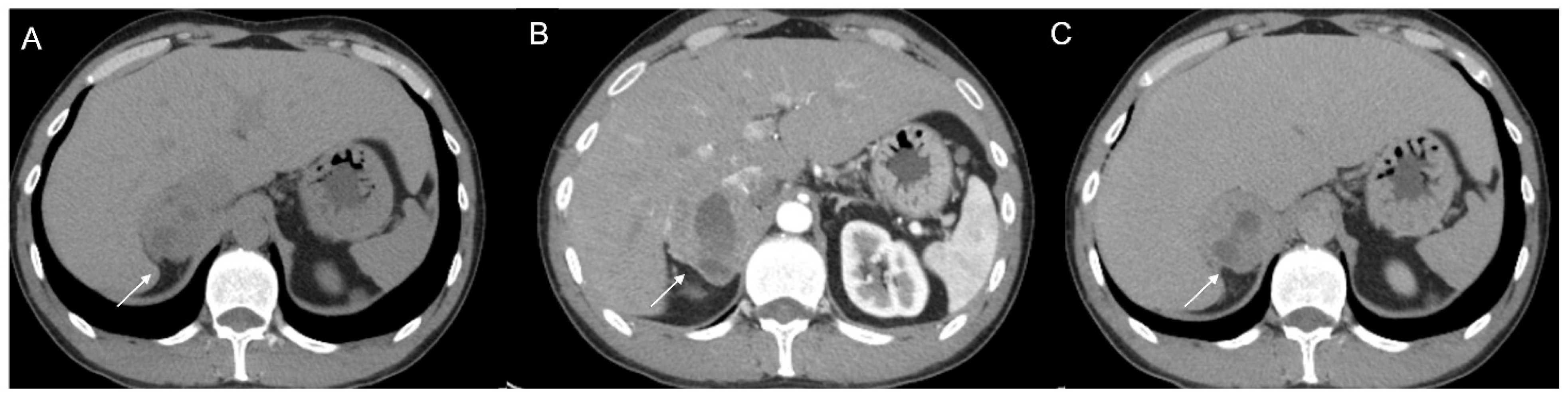 Cancers 17 00849 g004 Cancers 17 00849 g004