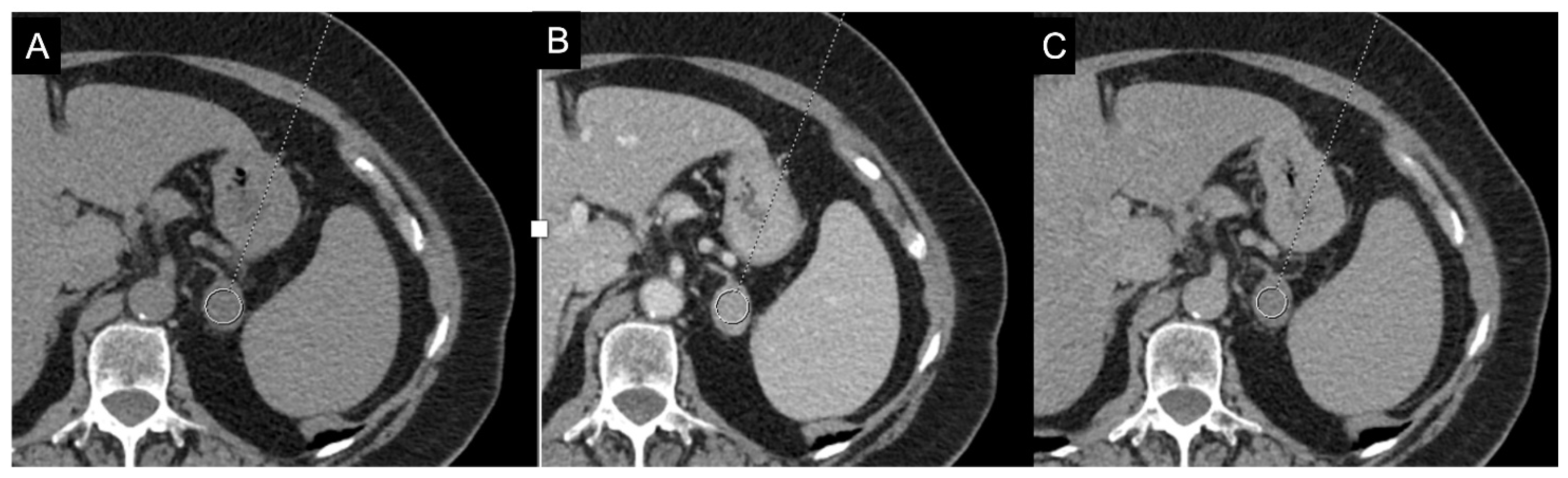 Cancers 17 00849 g008 Cancers 17 00849 g008