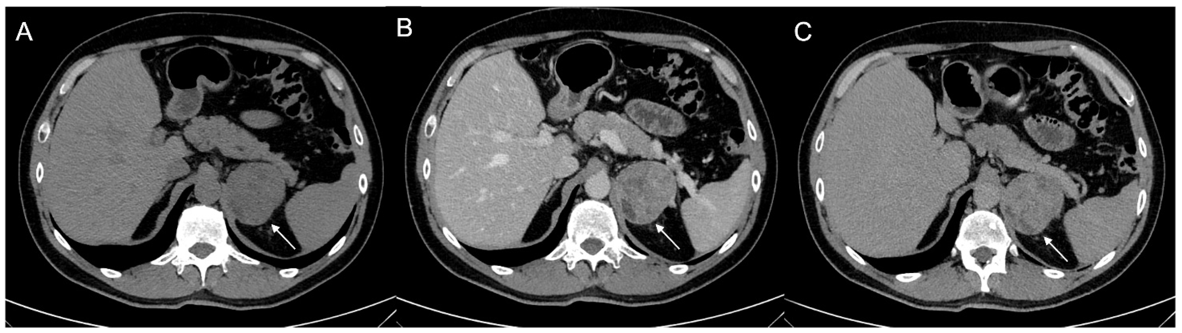 Cancers 17 00849 g009 Cancers 17 00849 g009