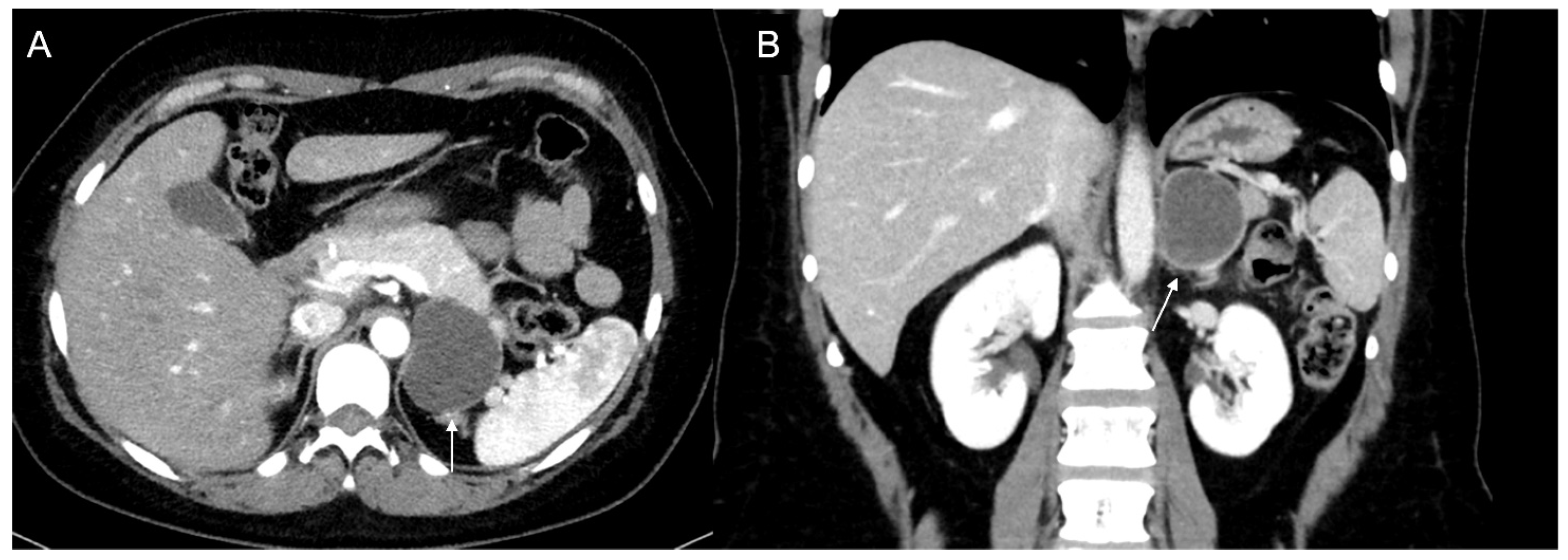 Cancers 17 00849 g010 Cancers 17 00849 g010