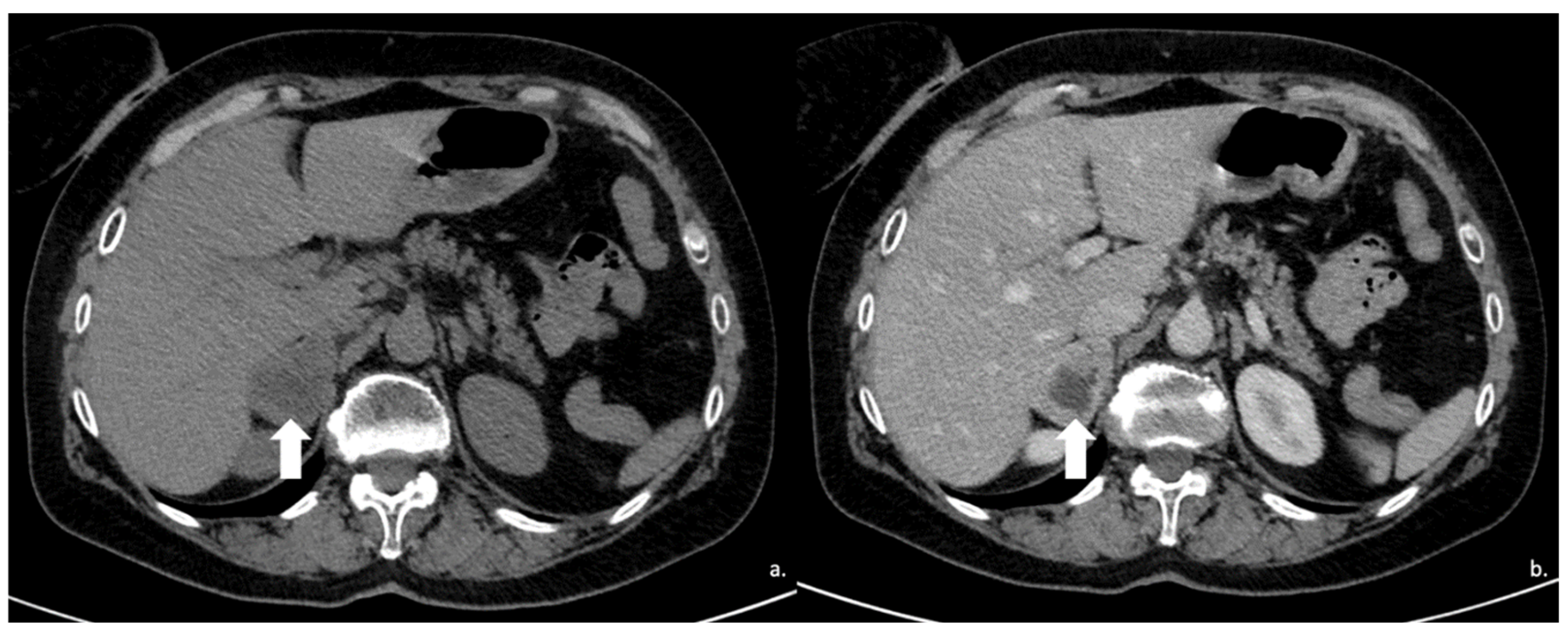 Cancers 17 00849 g012 Cancers 17 00849 g012