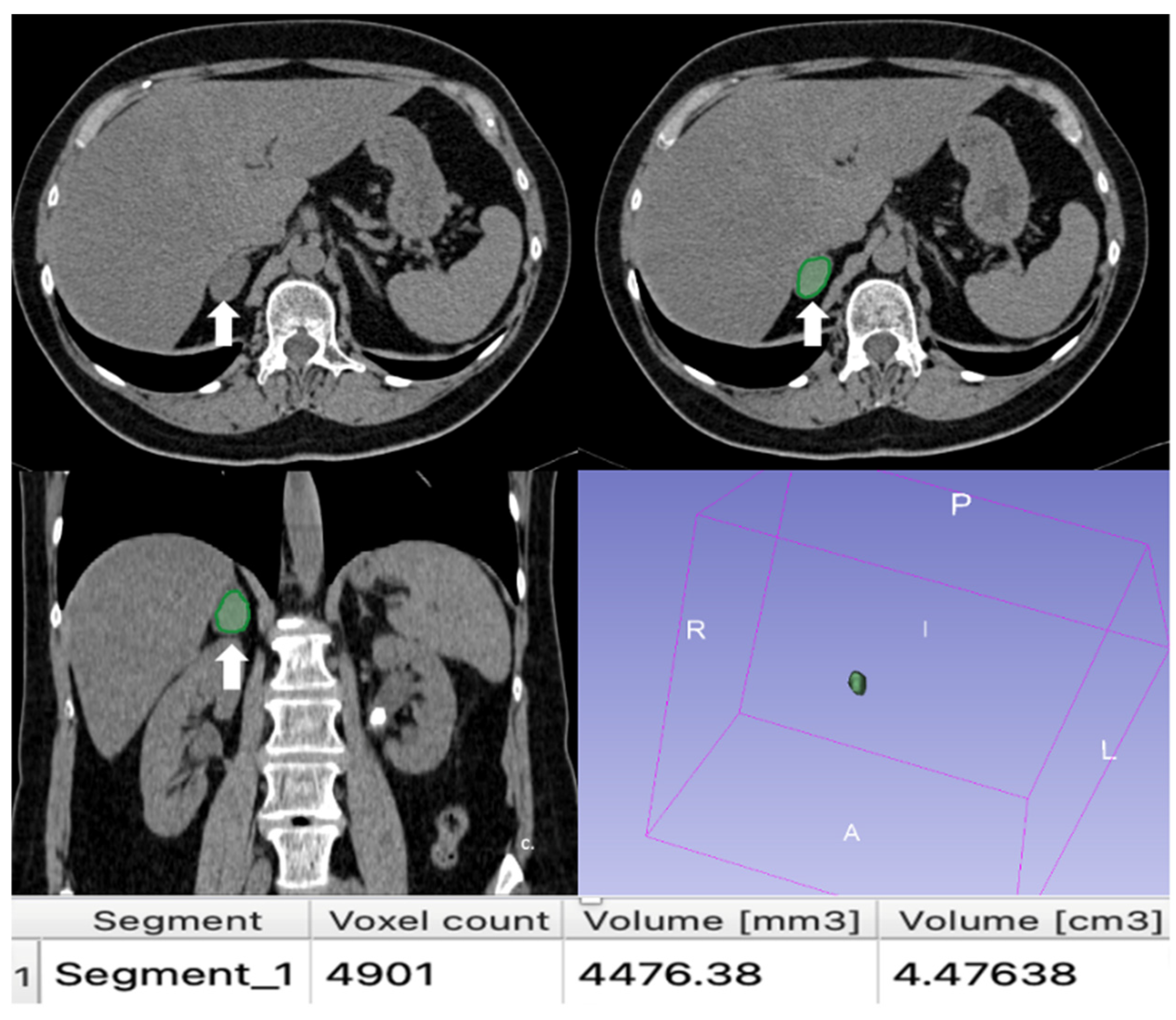 Cancers 17 00849 g013 Cancers 17 00849 g013