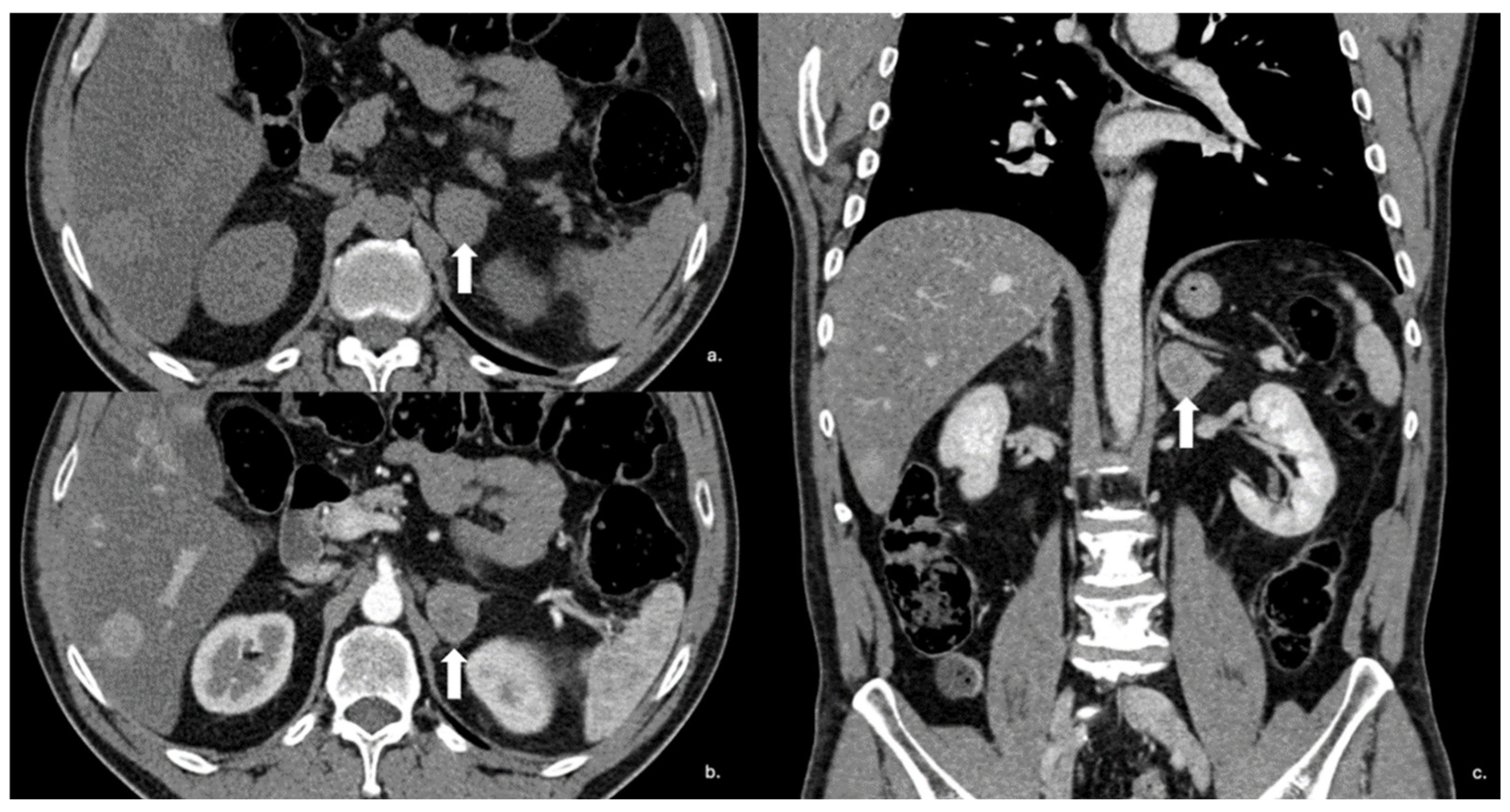 Cancers 17 00849 g014 Cancers 17 00849 g014