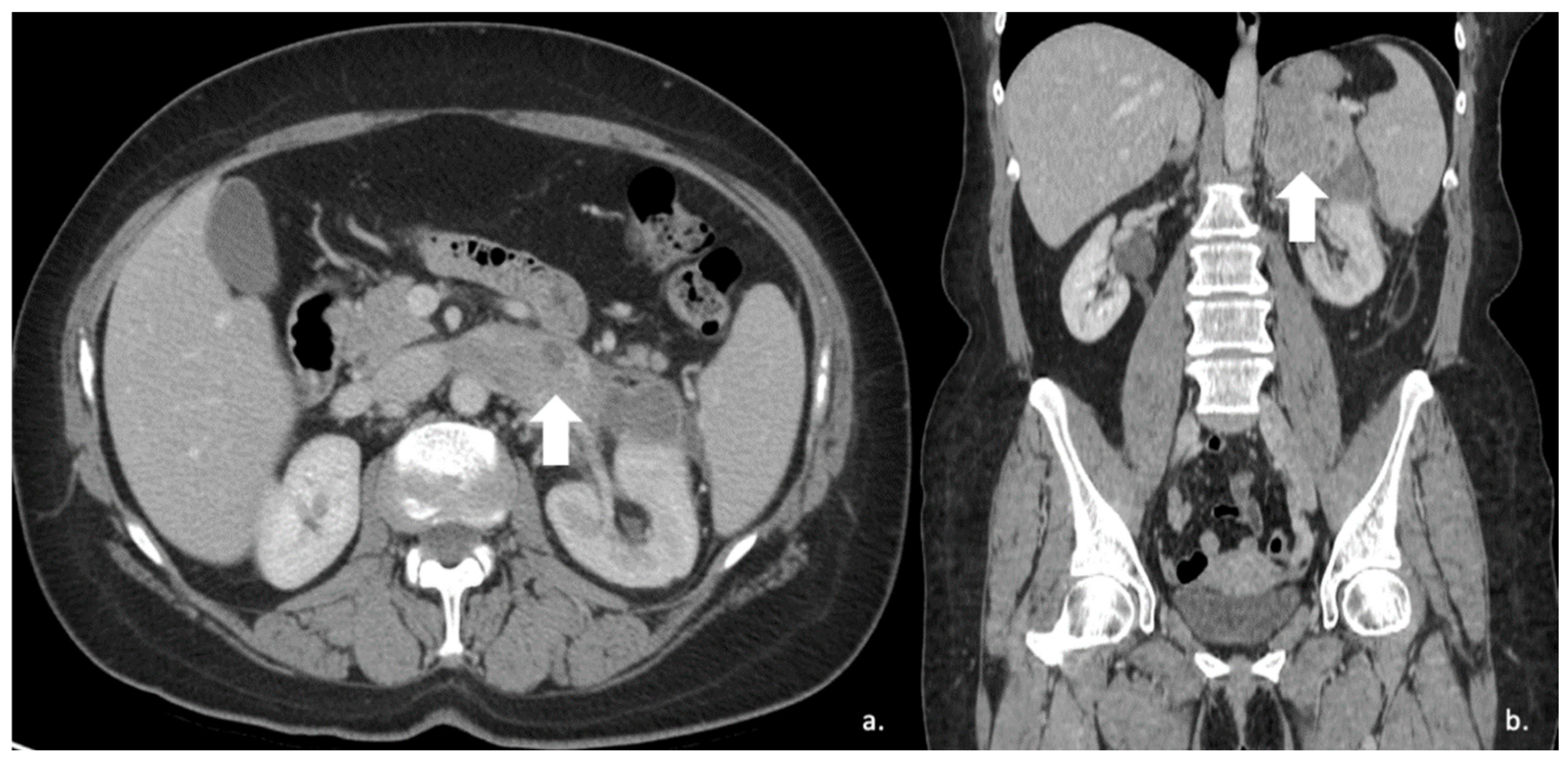 Cancers 17 00849 g016 Cancers 17 00849 g016