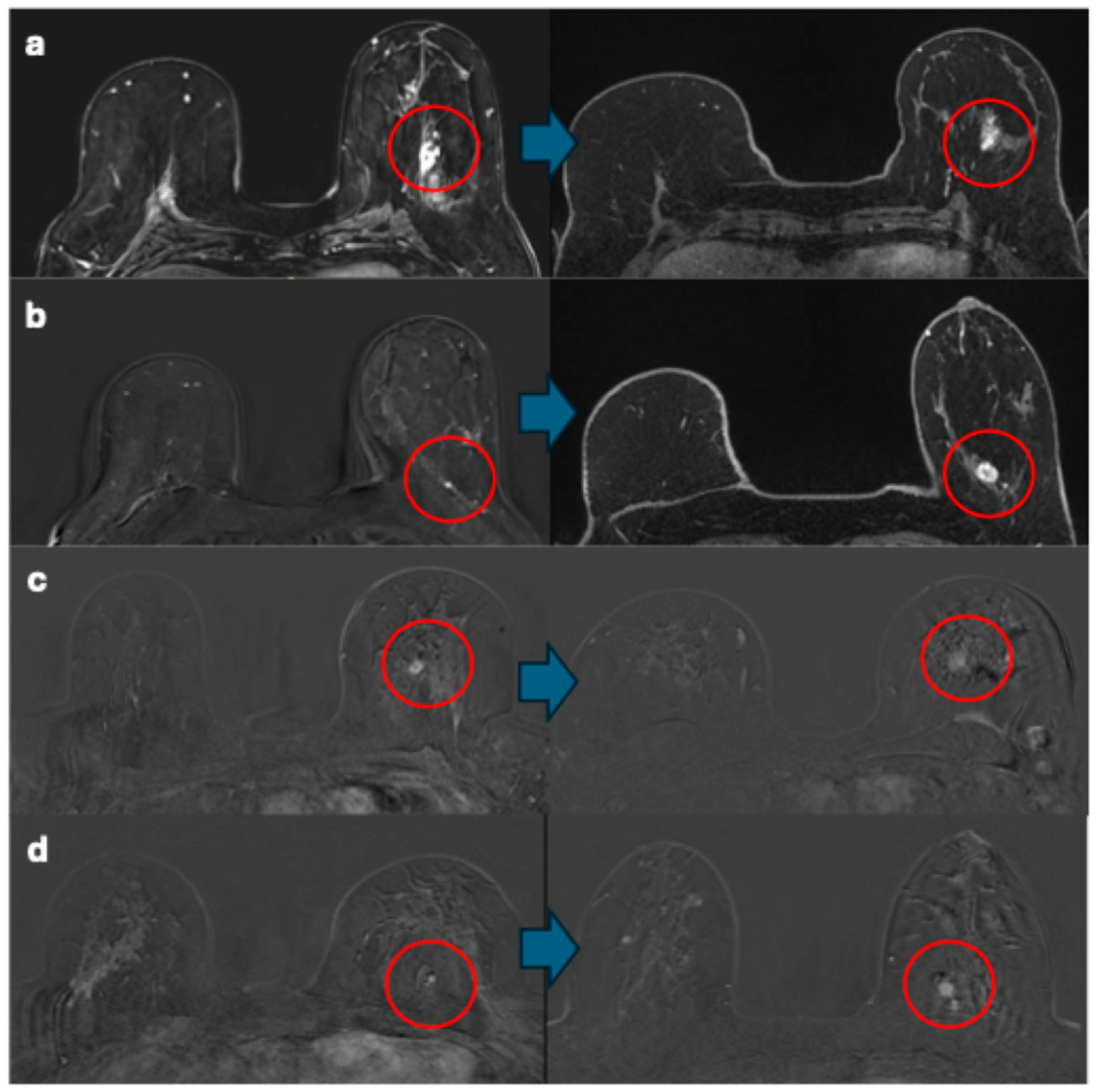 Cancers 17 00856 g005