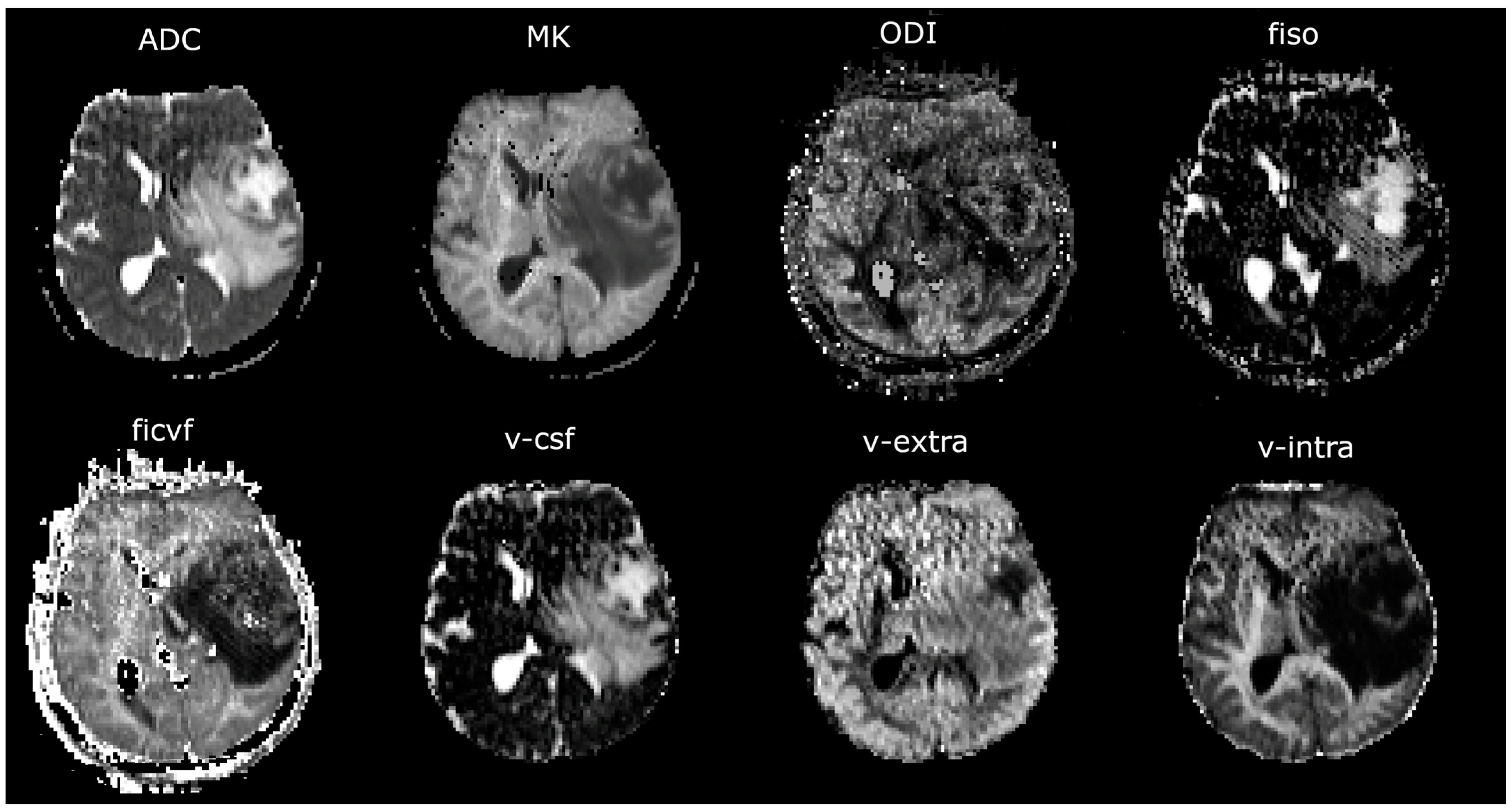 Cancers 17 00876 g002