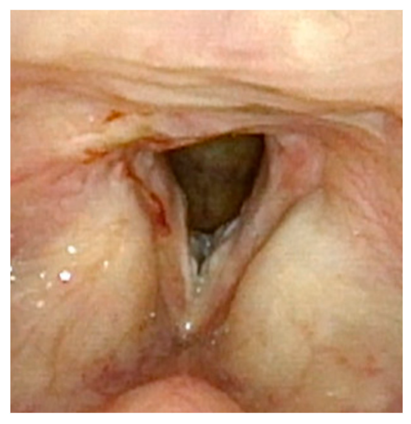 Cancers 17 00929 g002