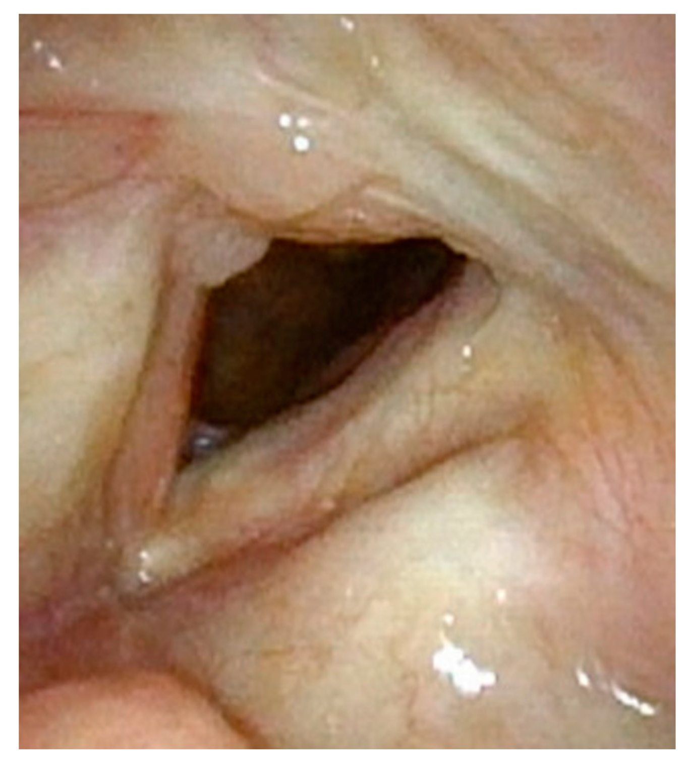 Cancers 17 00929 g003