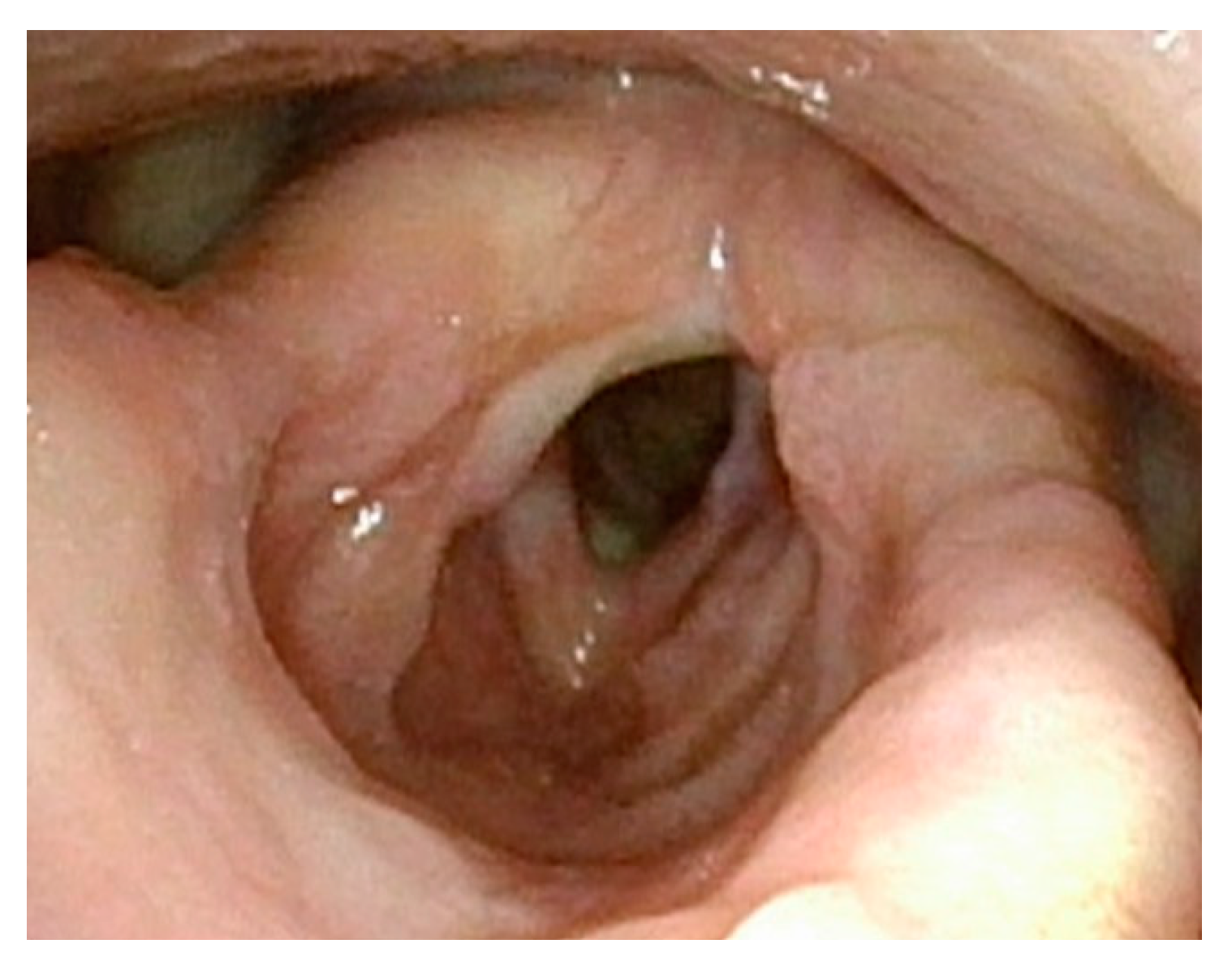 Cancers 17 00929 g005