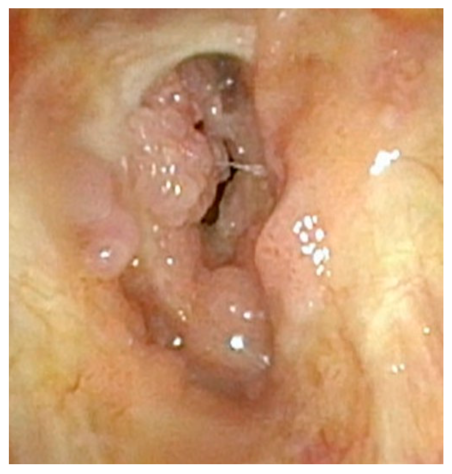 Cancers 17 00929 g006