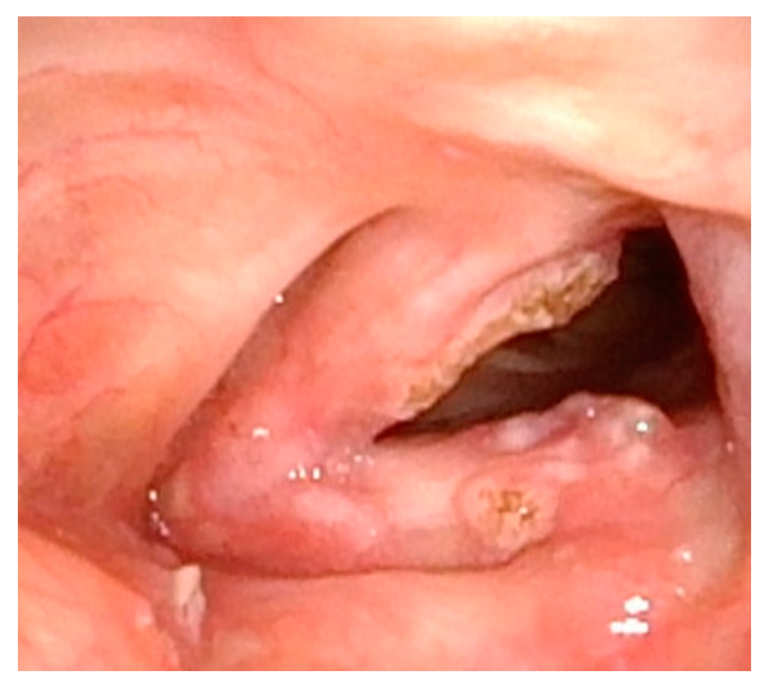 Cancers 17 00929 g008