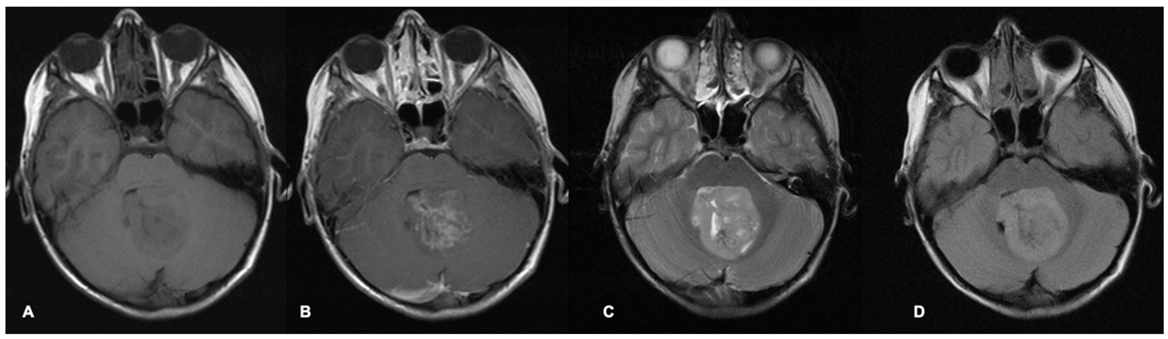 Cancers 17 00947 g001