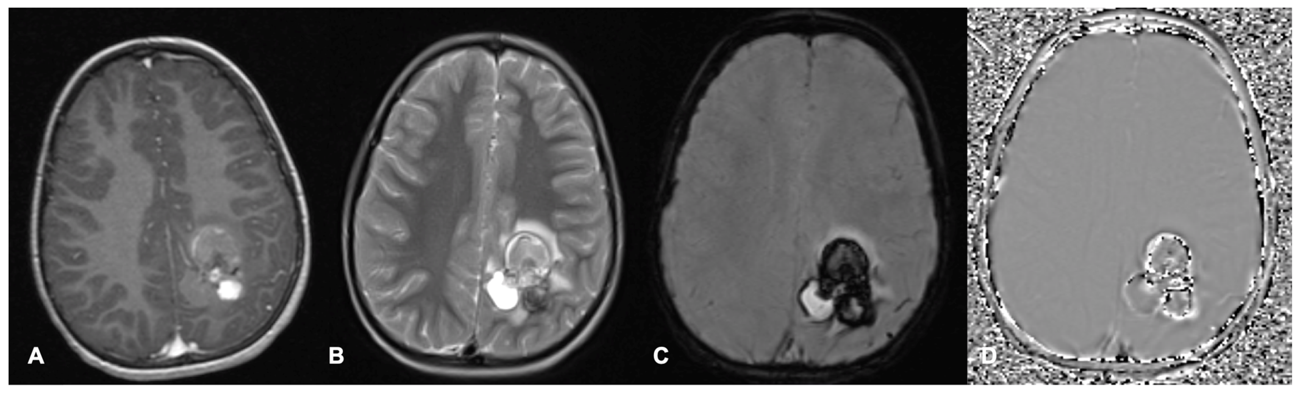 Cancers 17 00947 g002