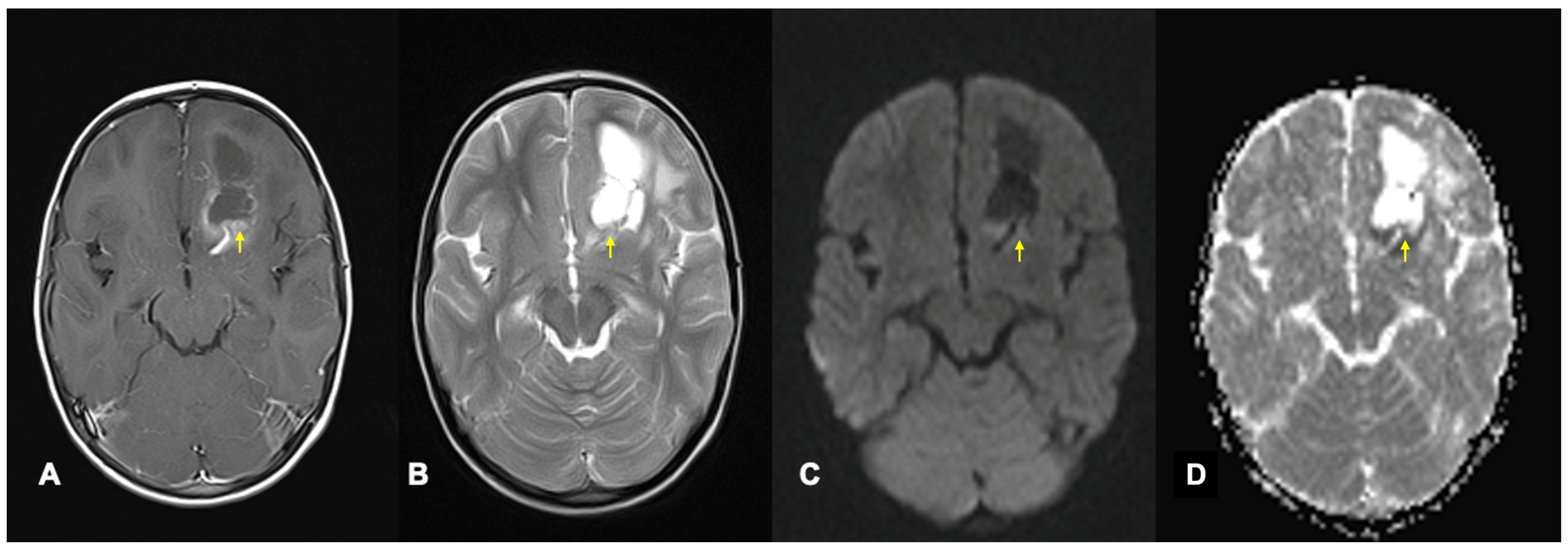 Cancers 17 00947 g003