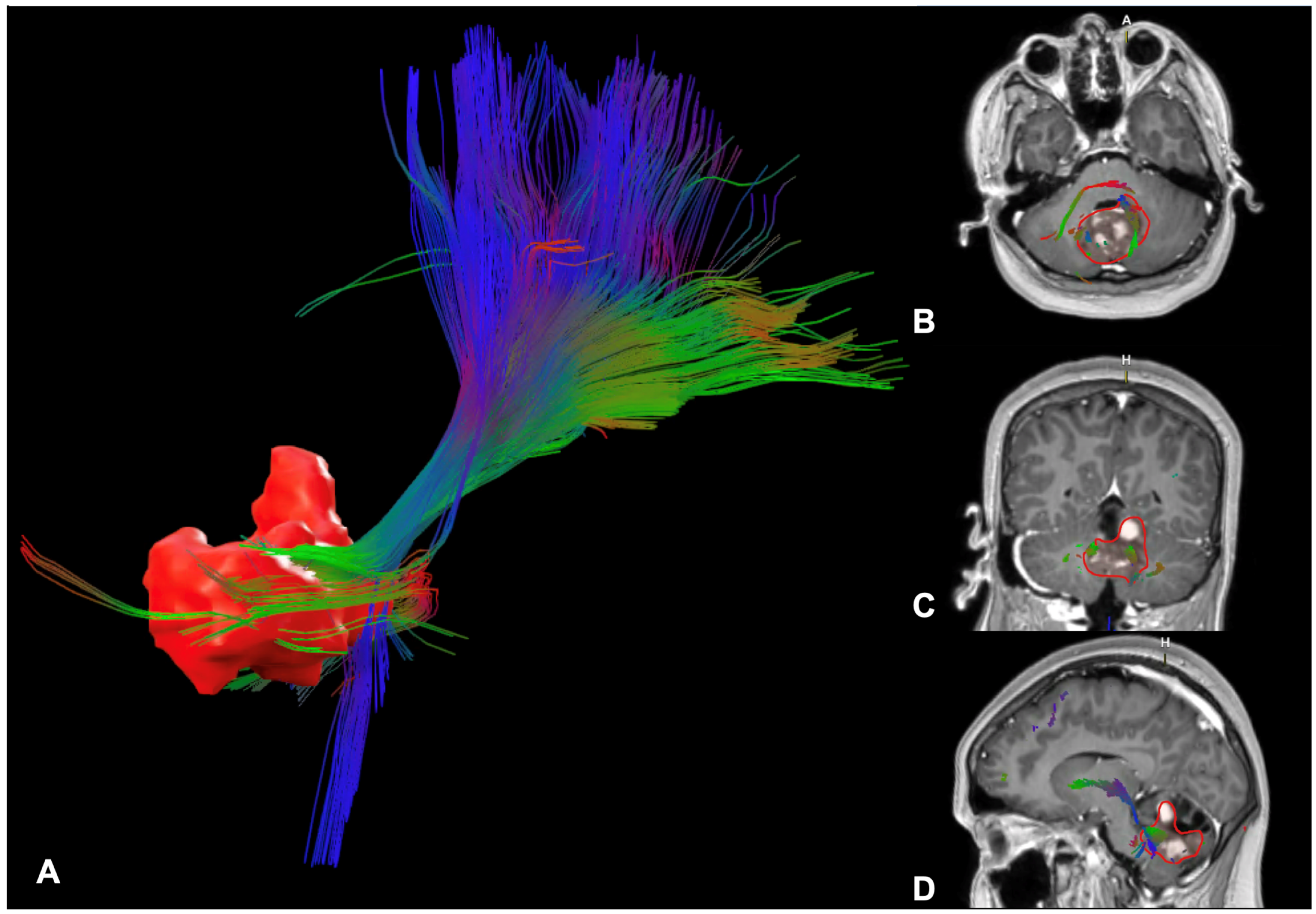 Cancers 17 00947 g004