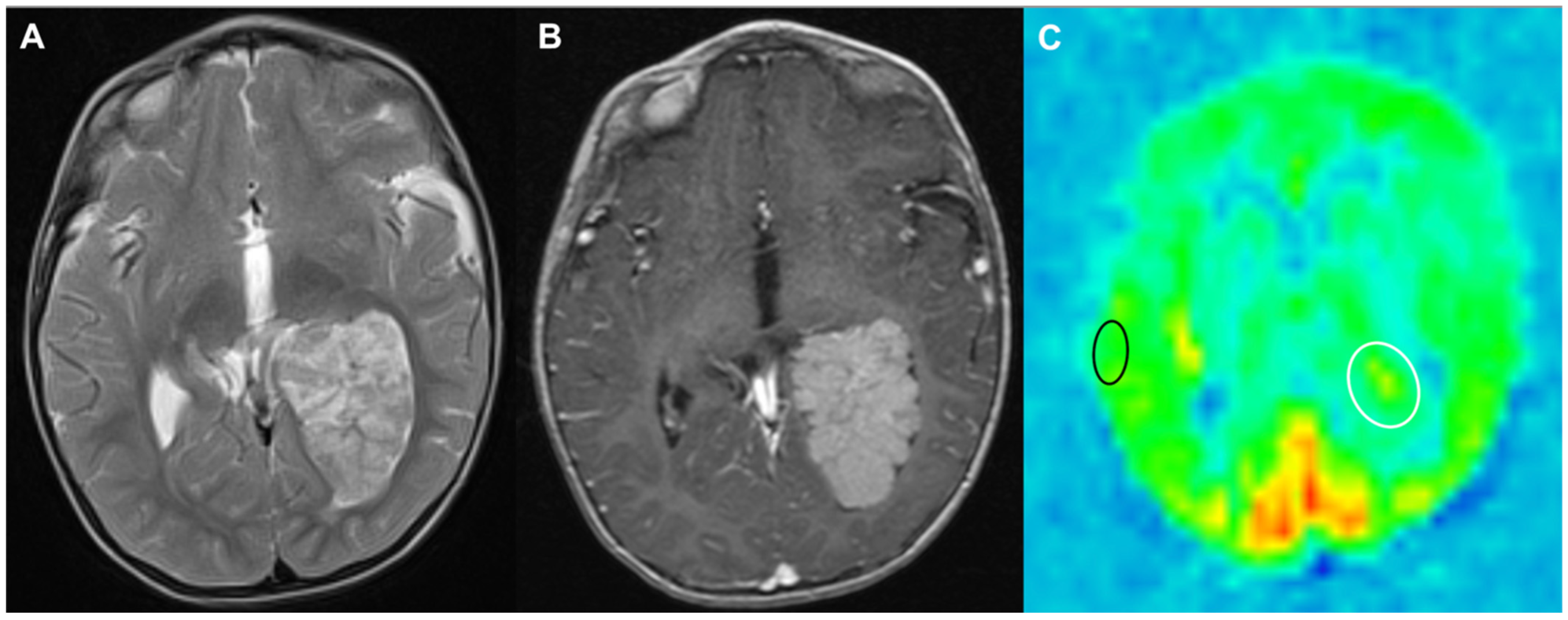 Cancers 17 00947 g005