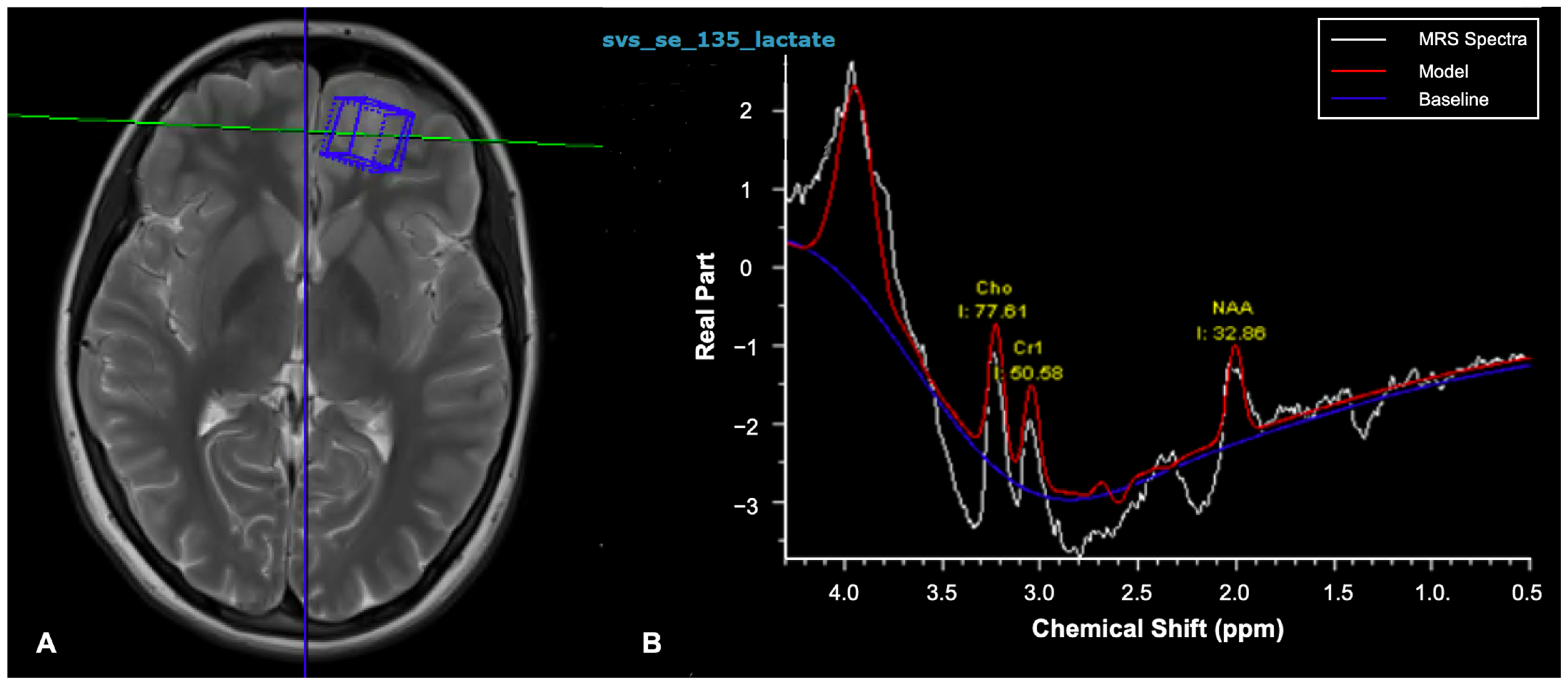 Cancers 17 00947 g006