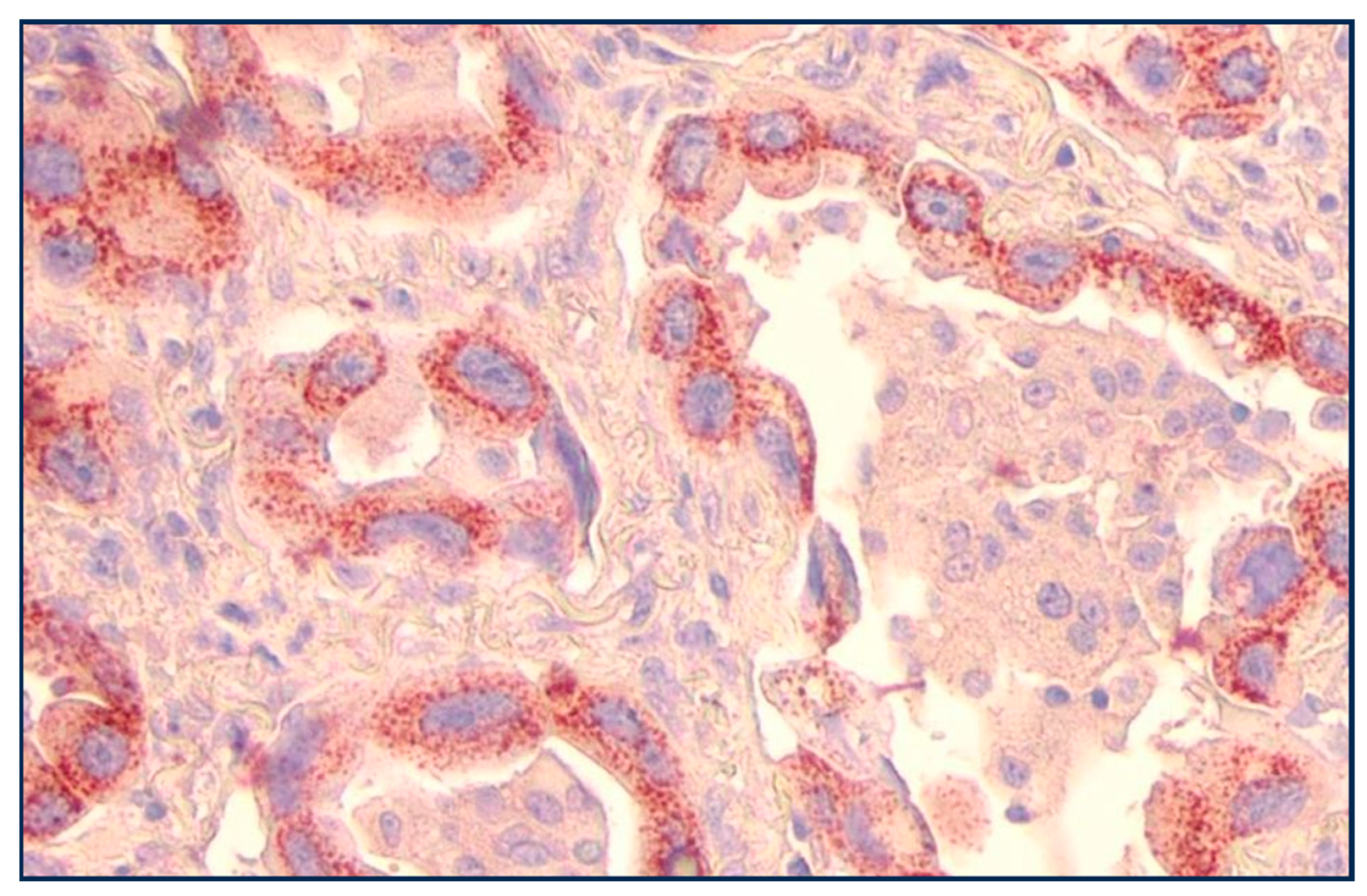 Cancers 17 00952 g004