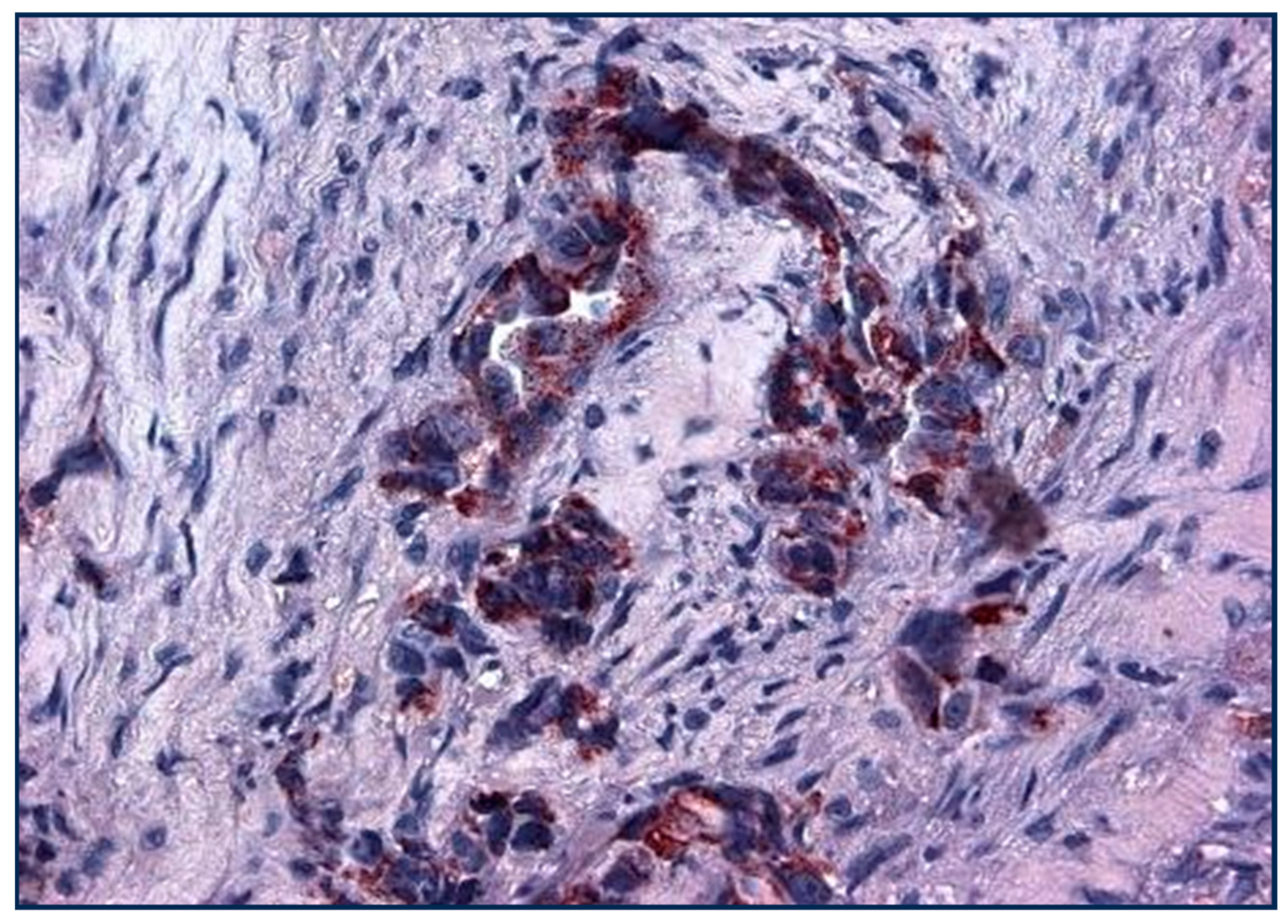 Cancers 17 00952 g006