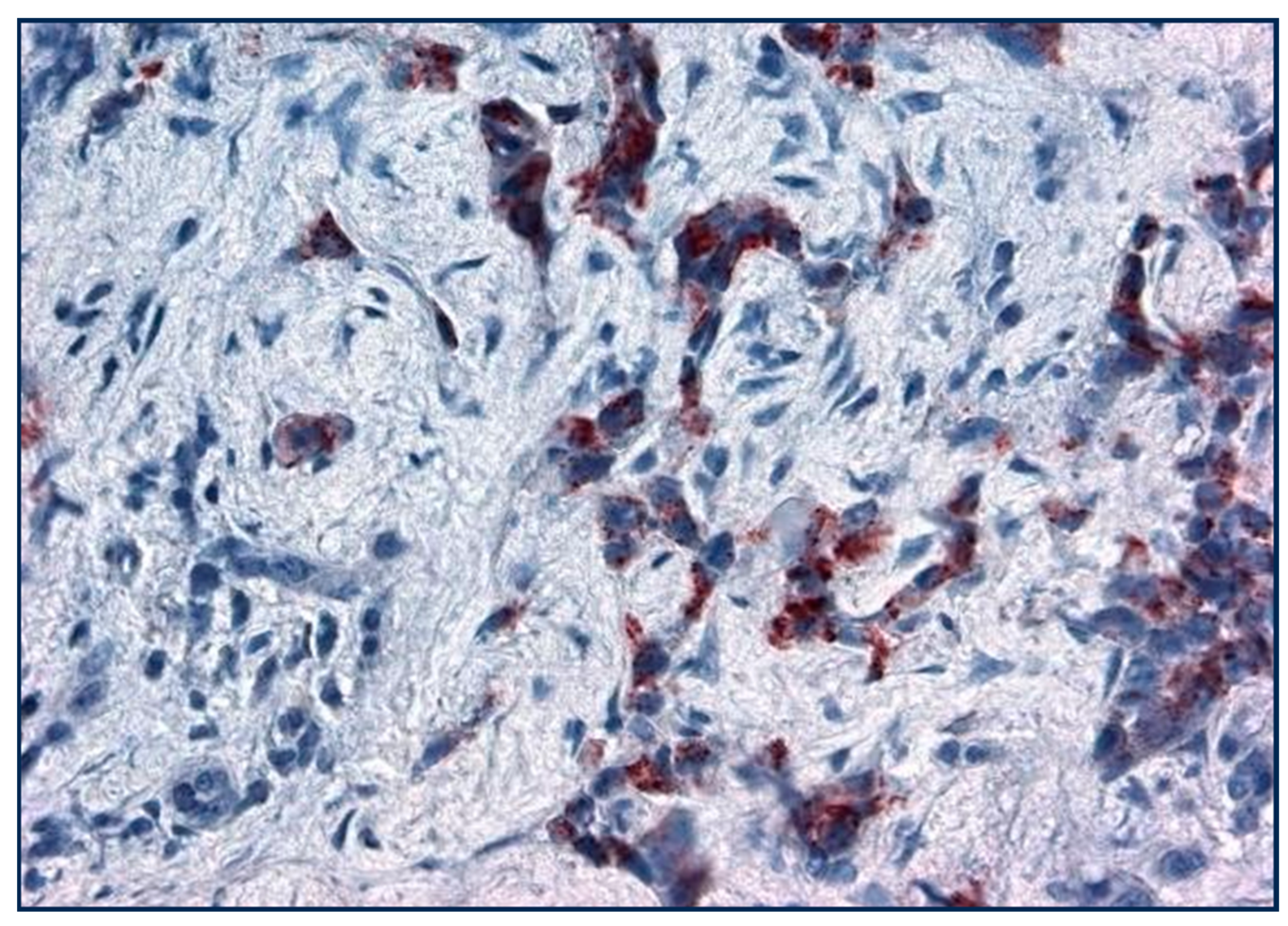 Cancers 17 00952 g007