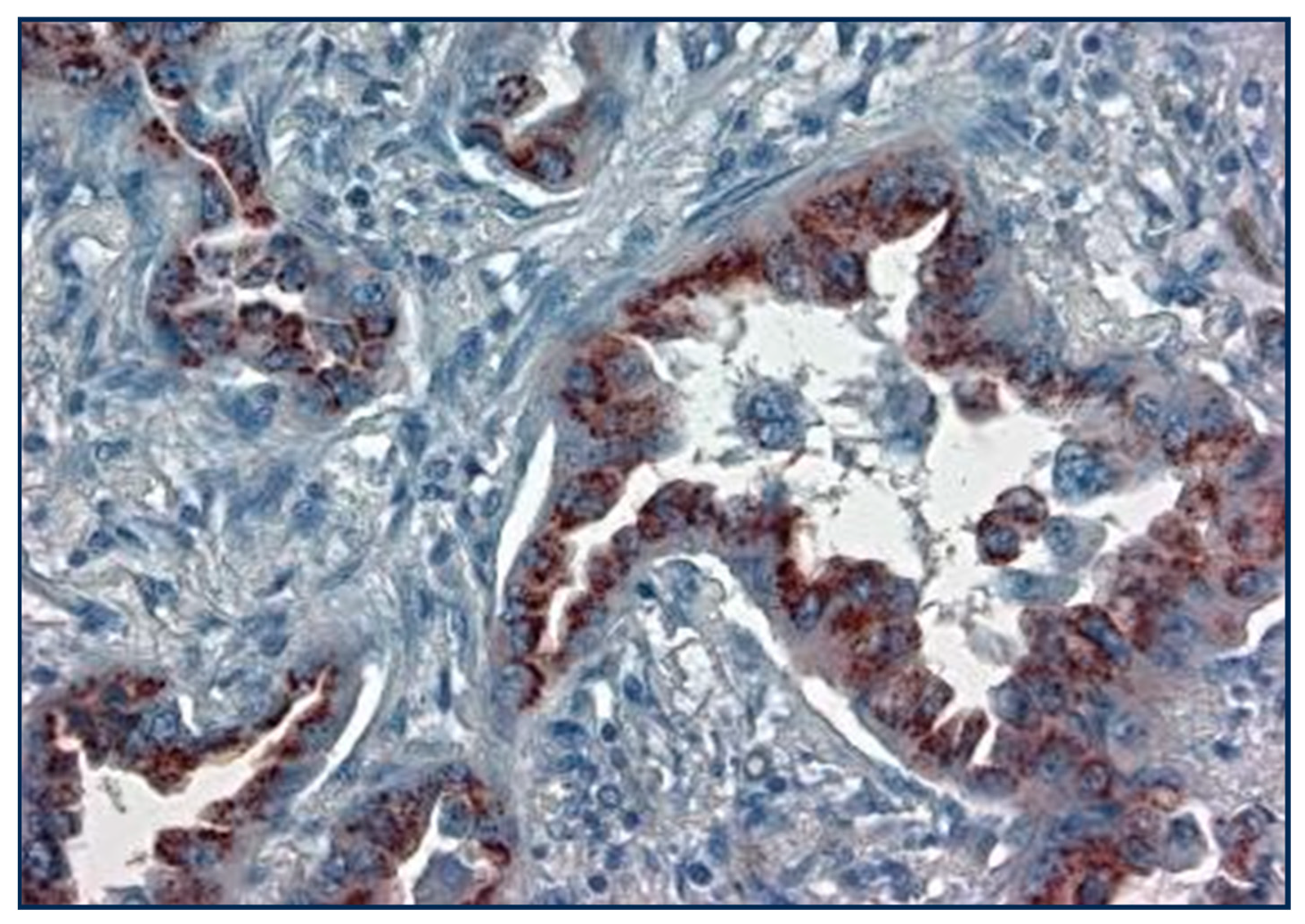 Cancers 17 00952 g008