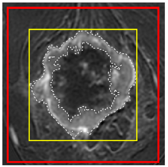 Cancers 17 00966 g0a2