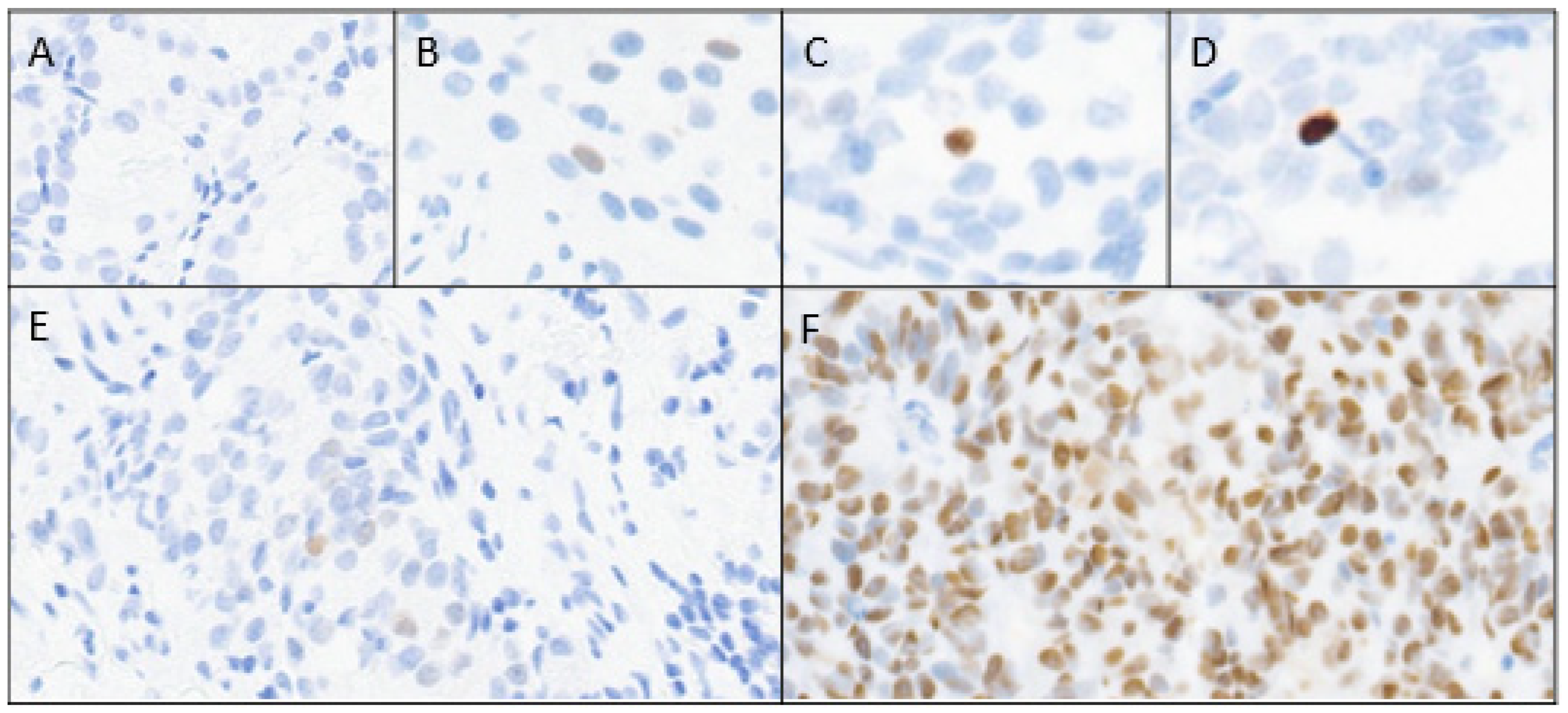 Cancers 17 01004 g001