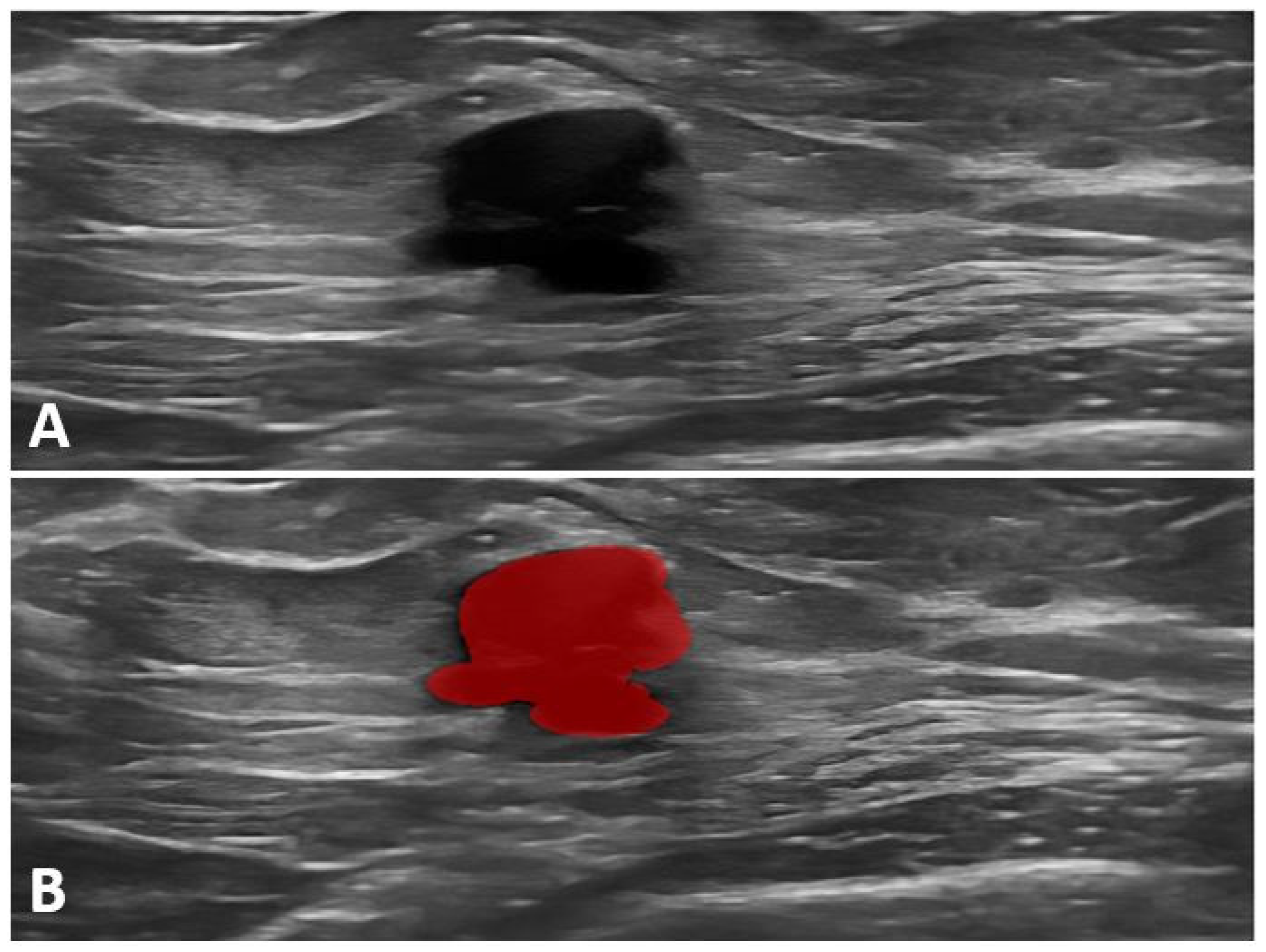 Cancers 17 01019 g002