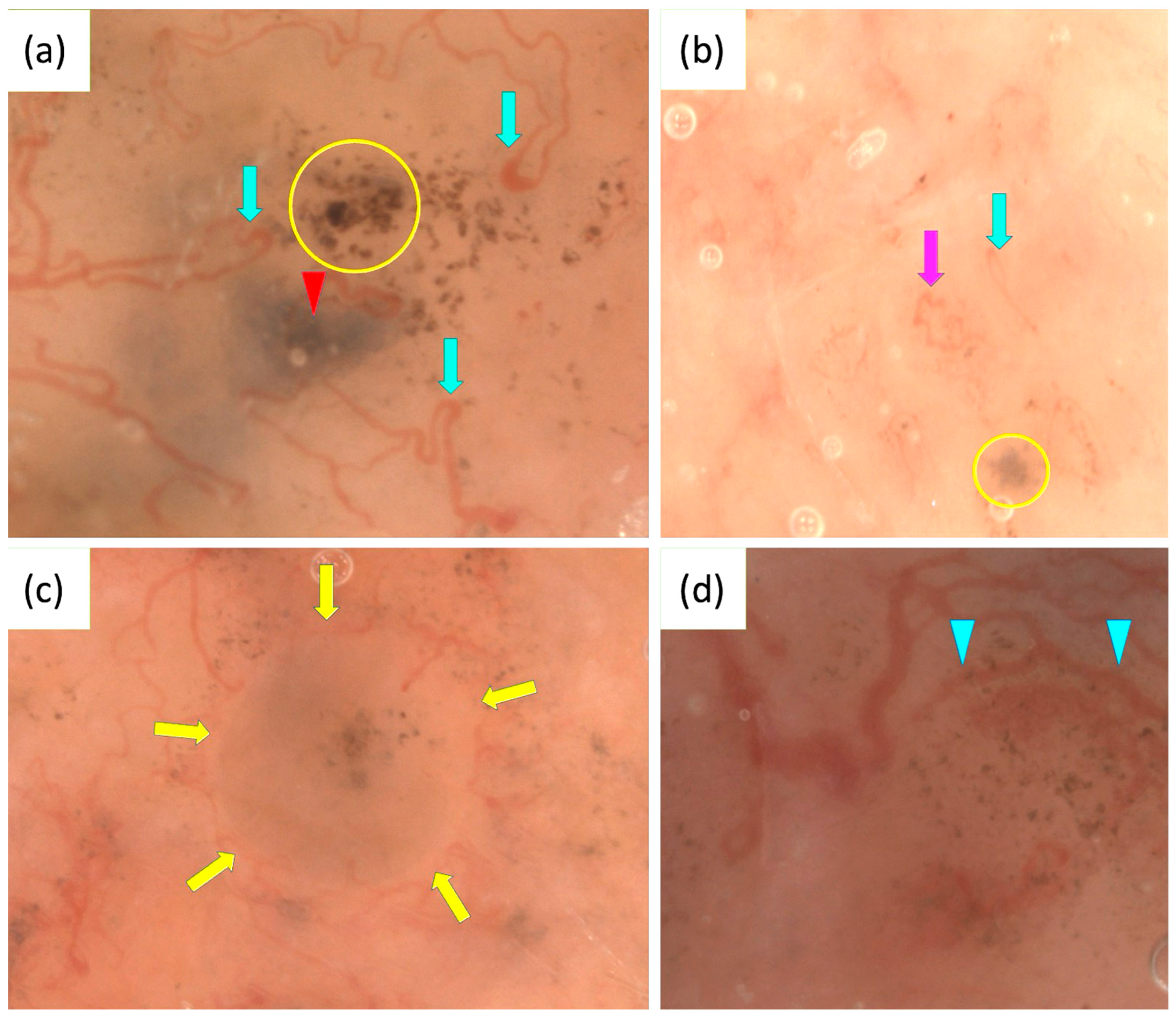 Cancers 17 01025 g003
