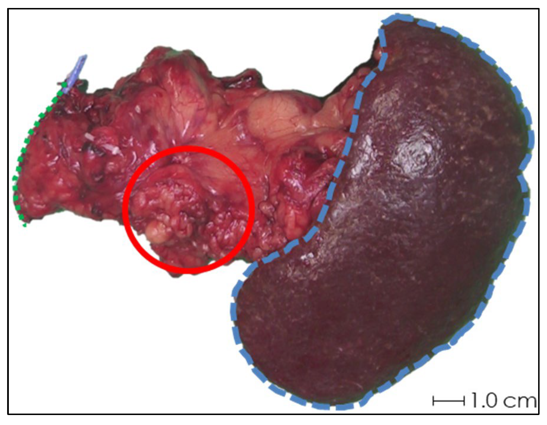 Cancers 17 01028 g003